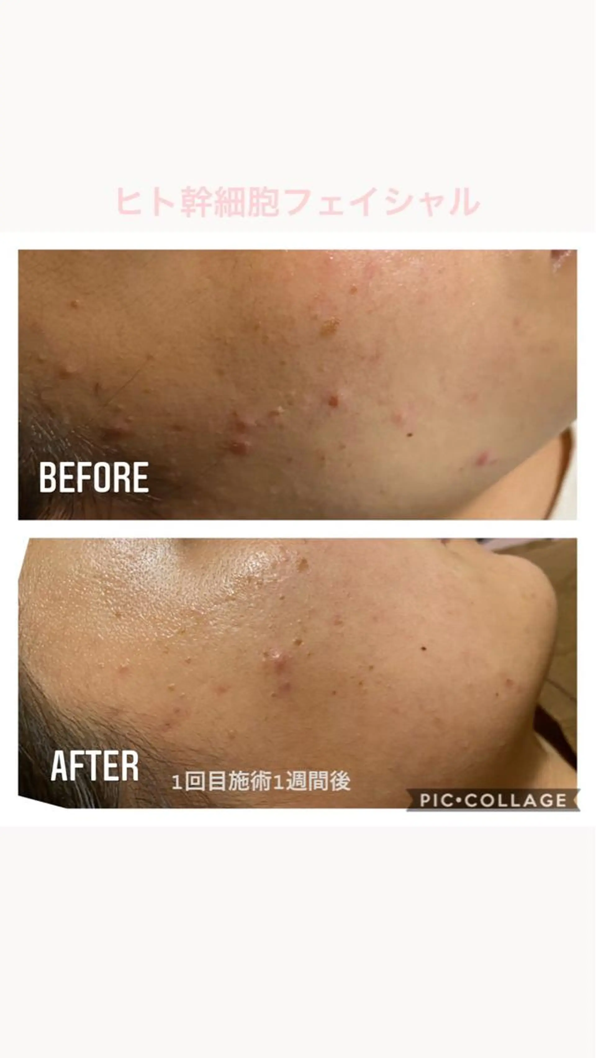 natura chuchuナトゥーラチュチュ所属・バスト体験 ナトゥーラチュチュのエステ・リラクイメージ