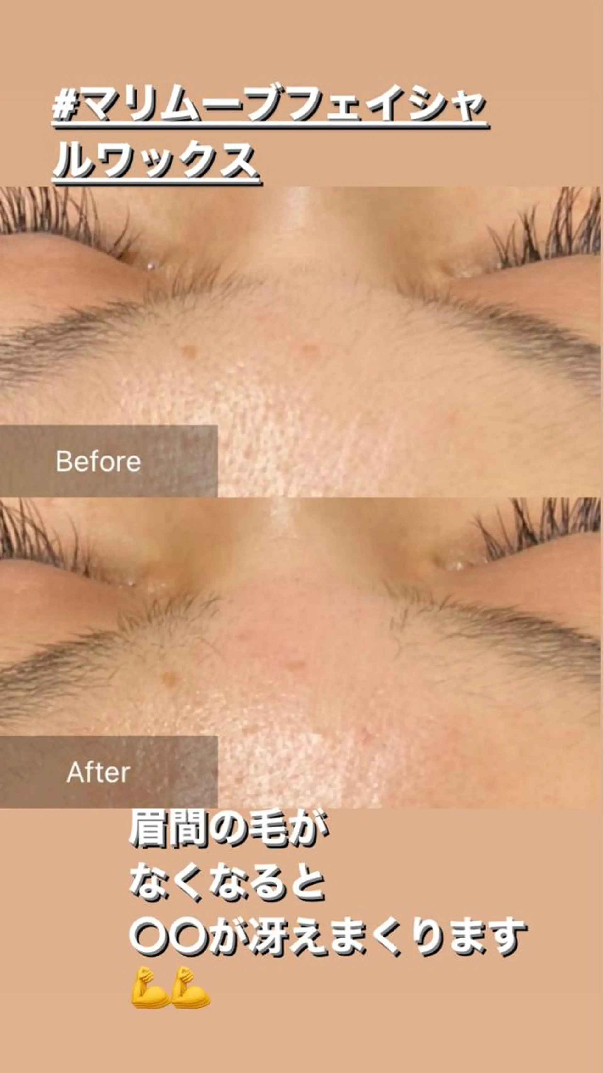 脱毛 産毛専門店 Bittoのエステ・リラクイメージ