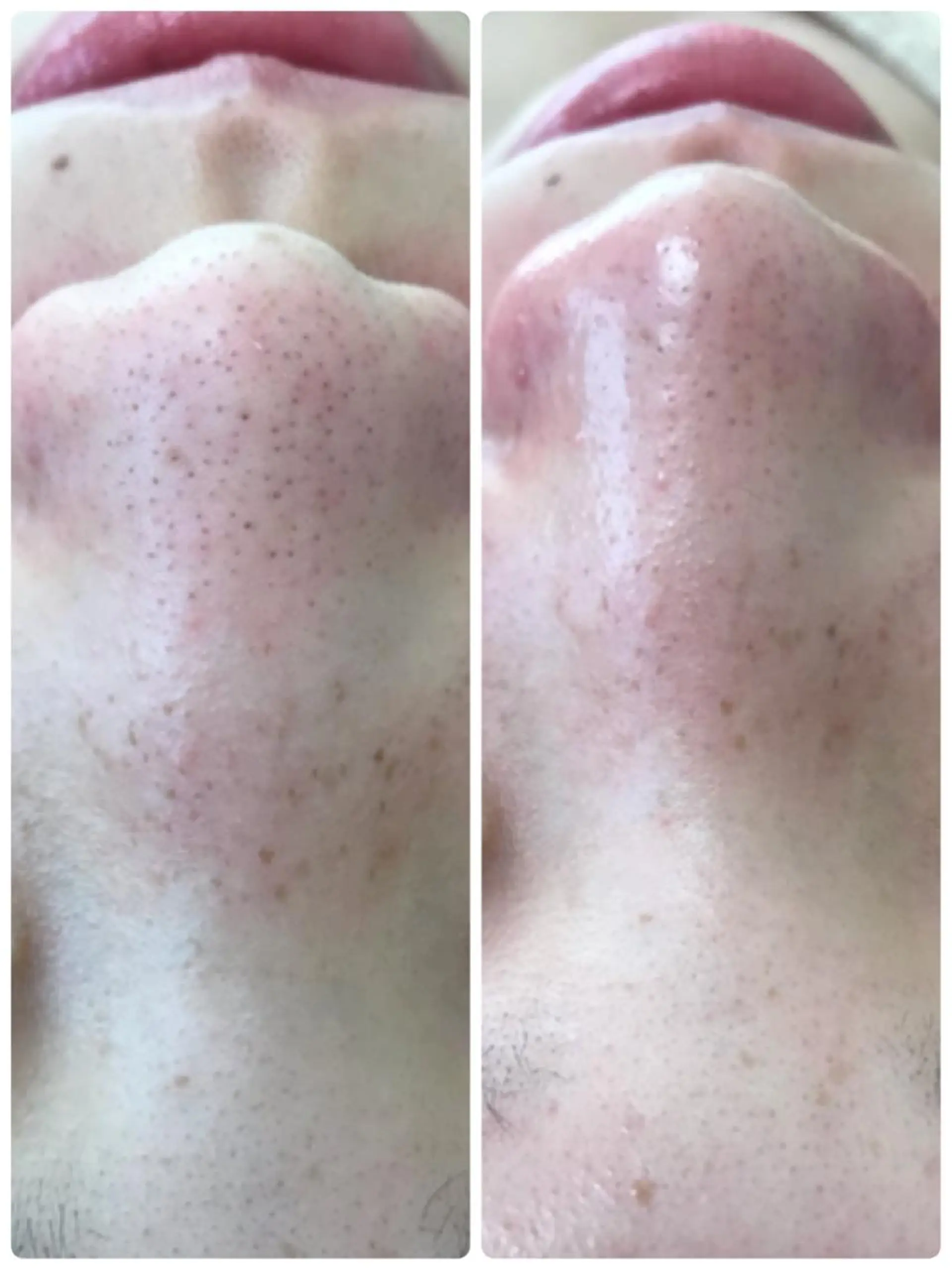 エステ トータルエステサロン Tiaraのエステ・リラクイメージ