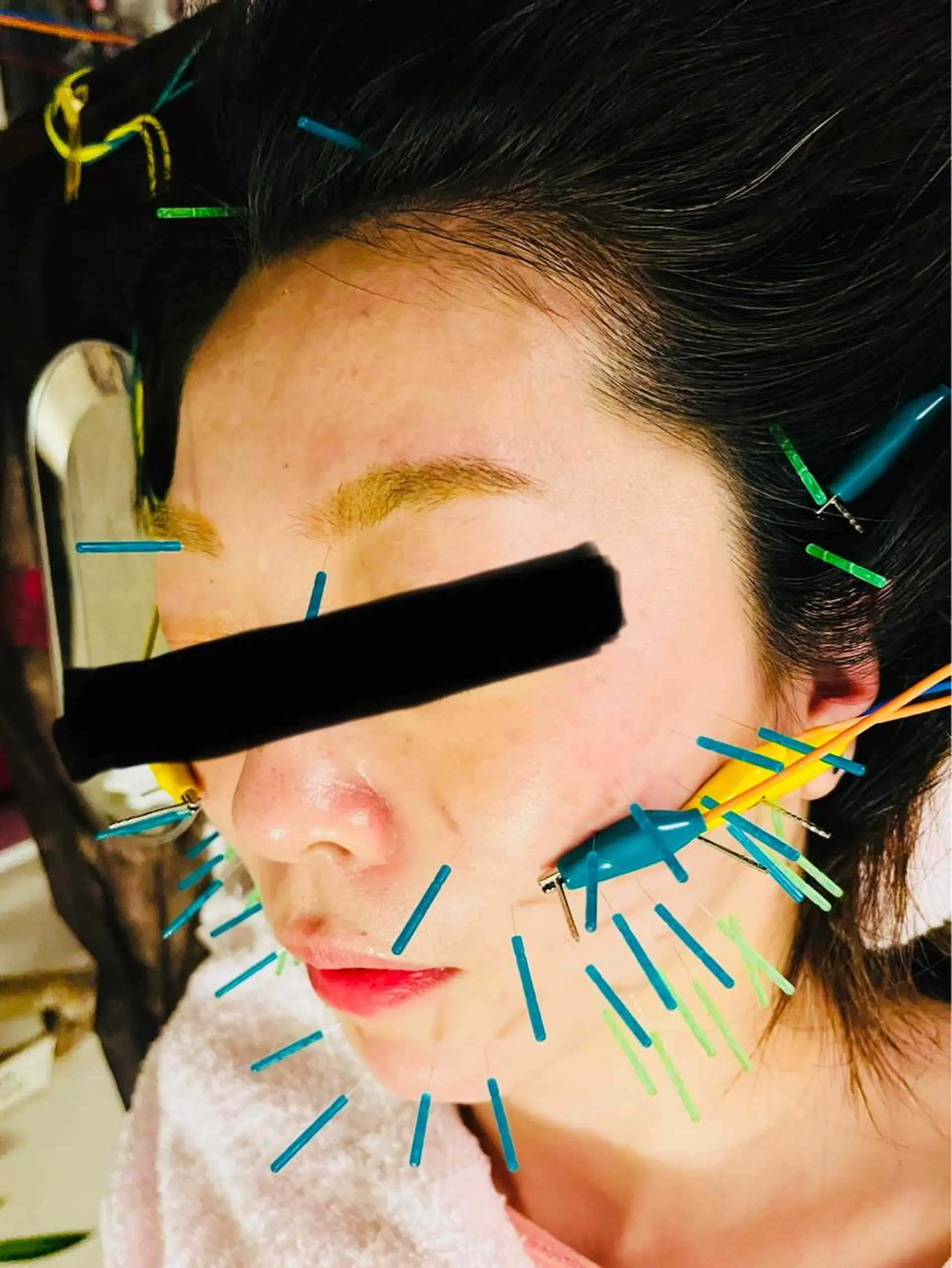 アロマ･美容鍼･カッ ピング「麗」鍼灸院のエステ・リラクイメージ