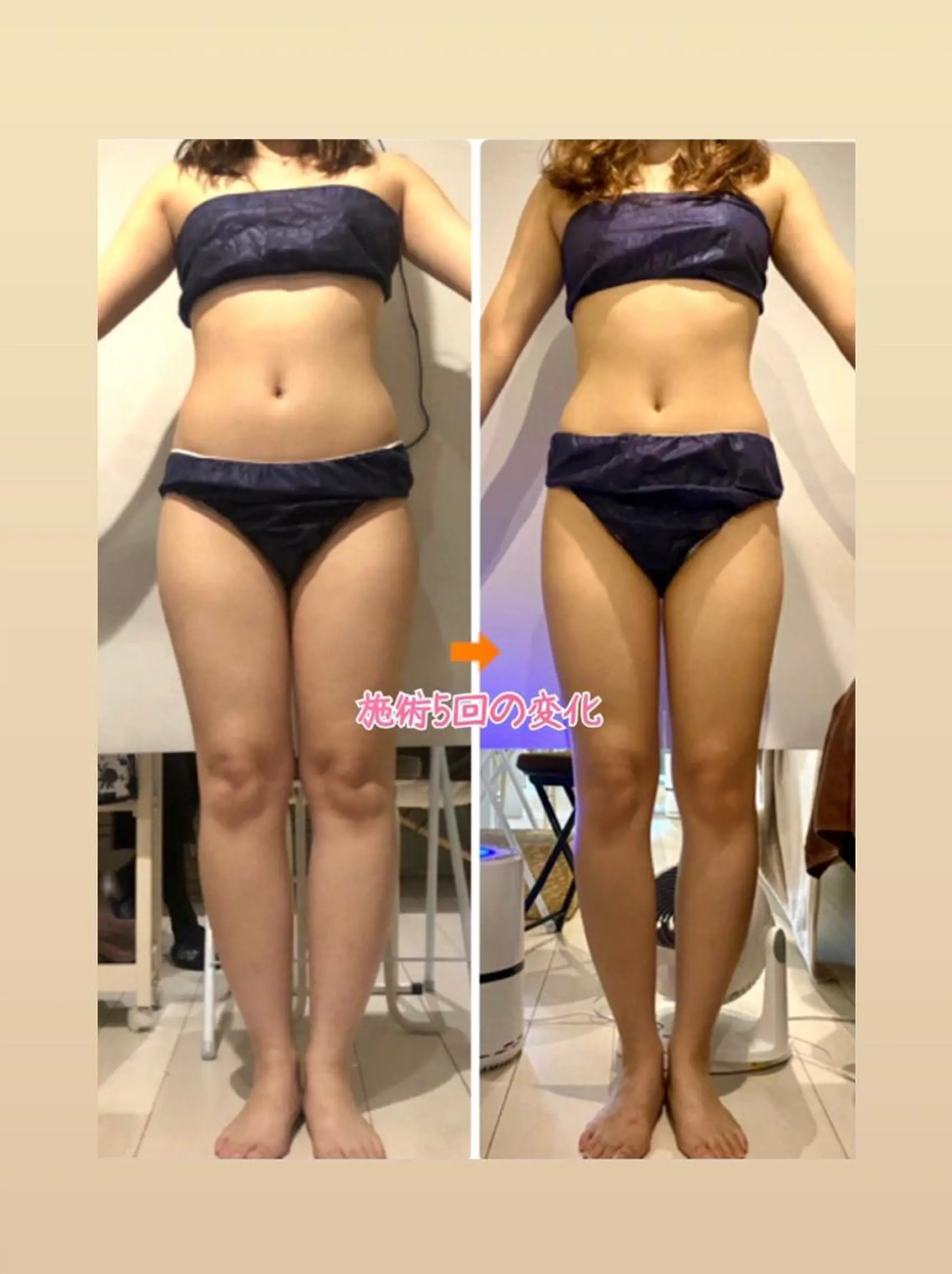 ショート カラー パーマ ヘアアレンジ メンズ キッズ ネイル マツエク・マツパ ‍痩身＆ボディ 結果出し🌟丹野のエステ・リラクイメージ