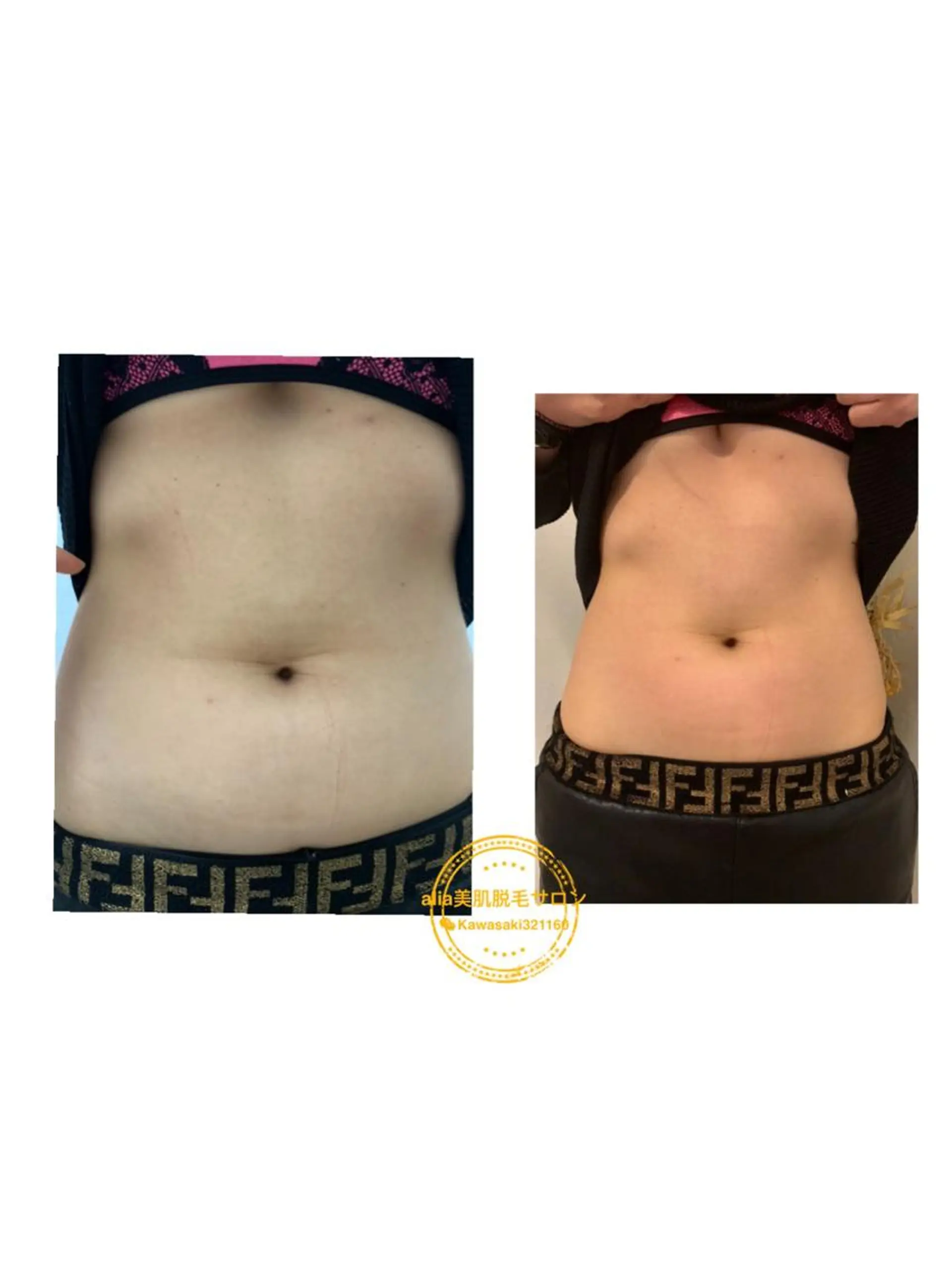 aliaハーブ水光店 エステティシャン募集のエステ・リラクイメージ