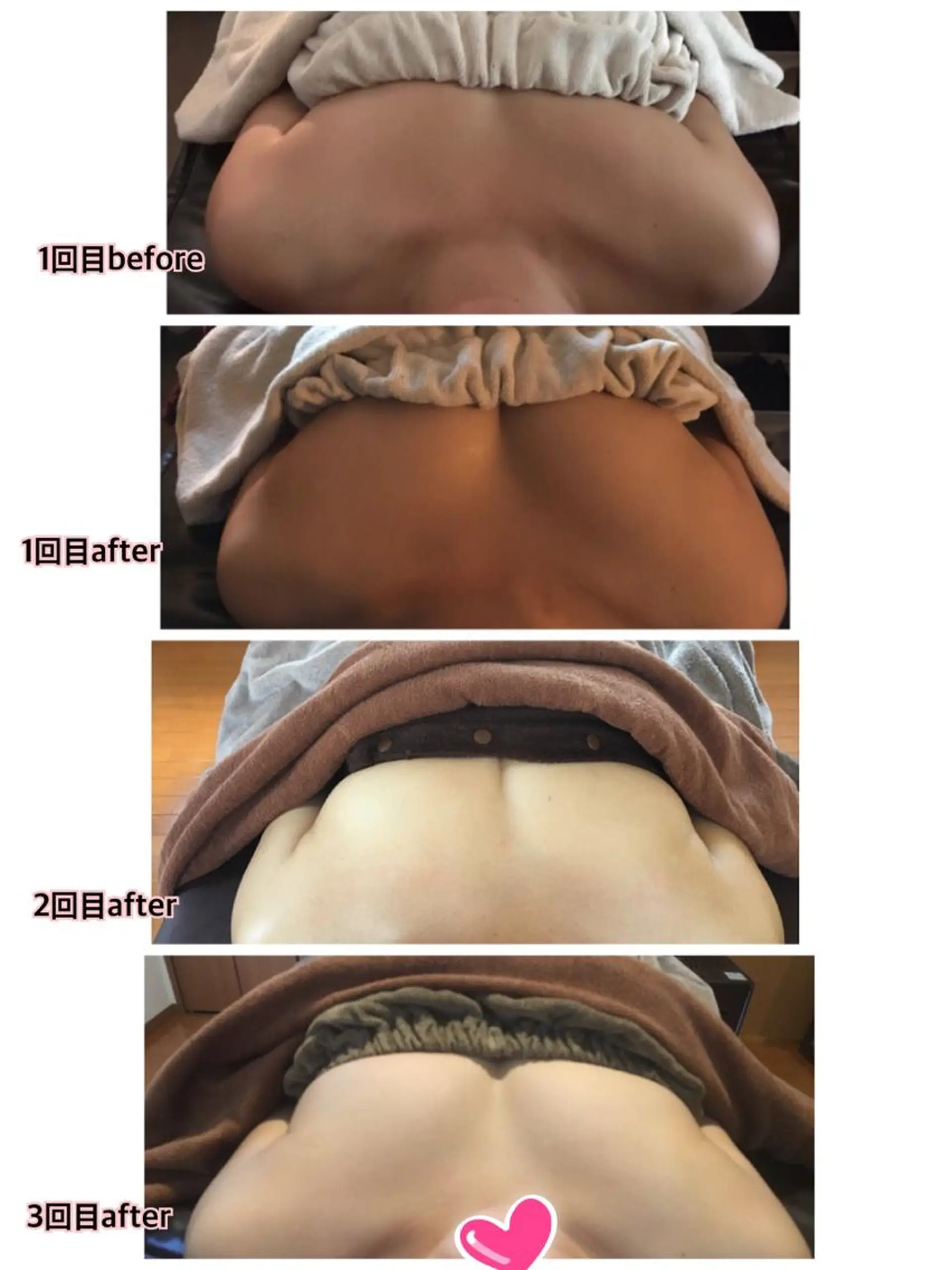 バストアップサロン エミルカのその他イメージ