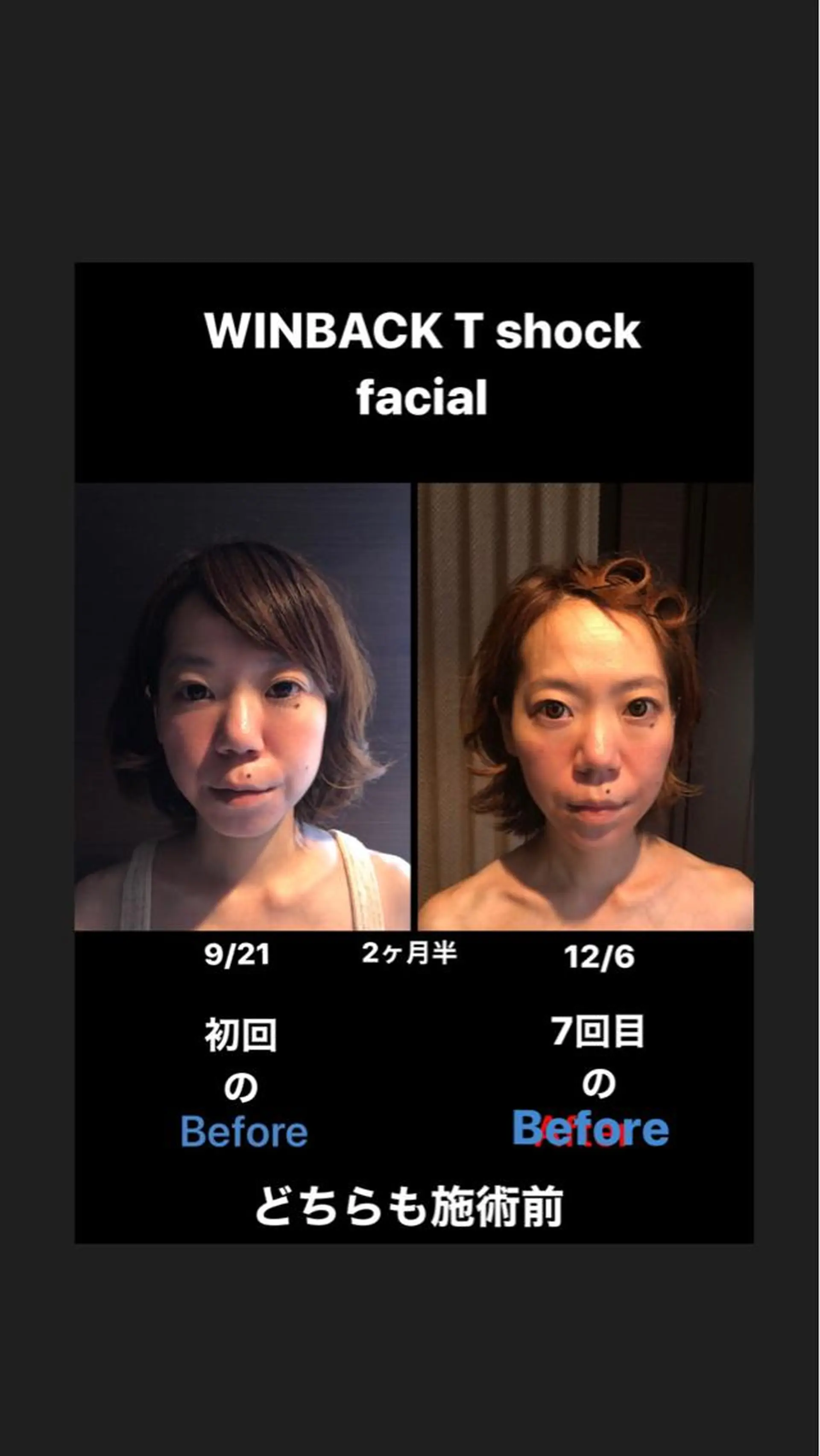 WINBACK salon　un agio所属・サロンドアンアージョ un agioのエステ・リラクイメージ