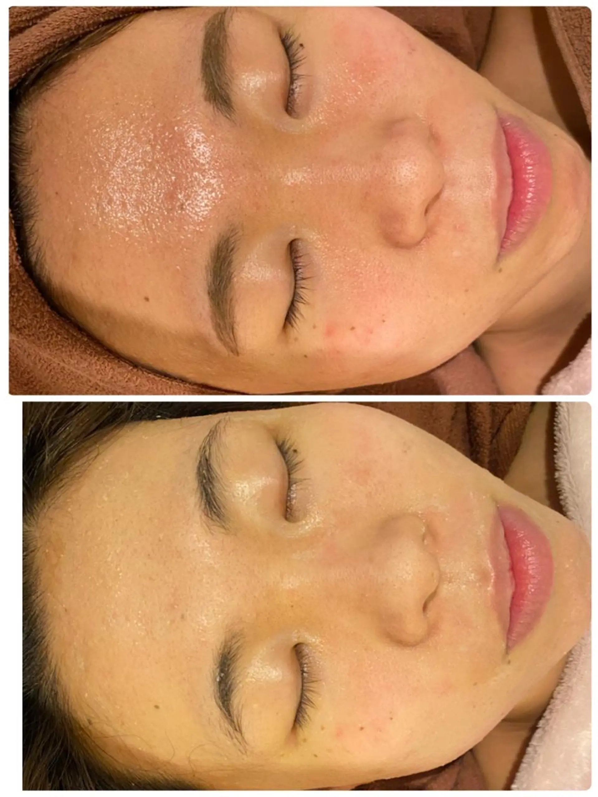 セミロング カラー パーマ ヘアアレンジ メンズ キッズ ネイル マツエク・マツパ アイブロウ 3か月で肌革命👼 ニキビ専門店💫のエステ・リラクイメージ