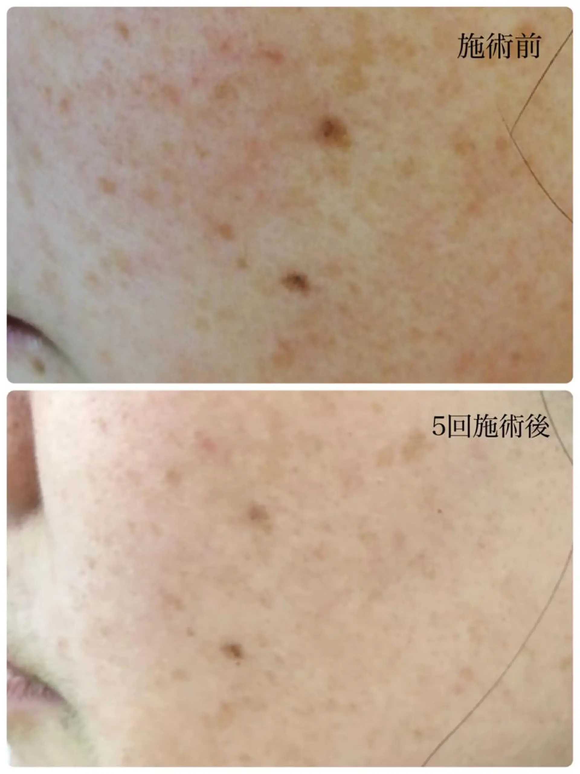 エステ／ネイル/脱毛 R.Msalonのネイルデザイン