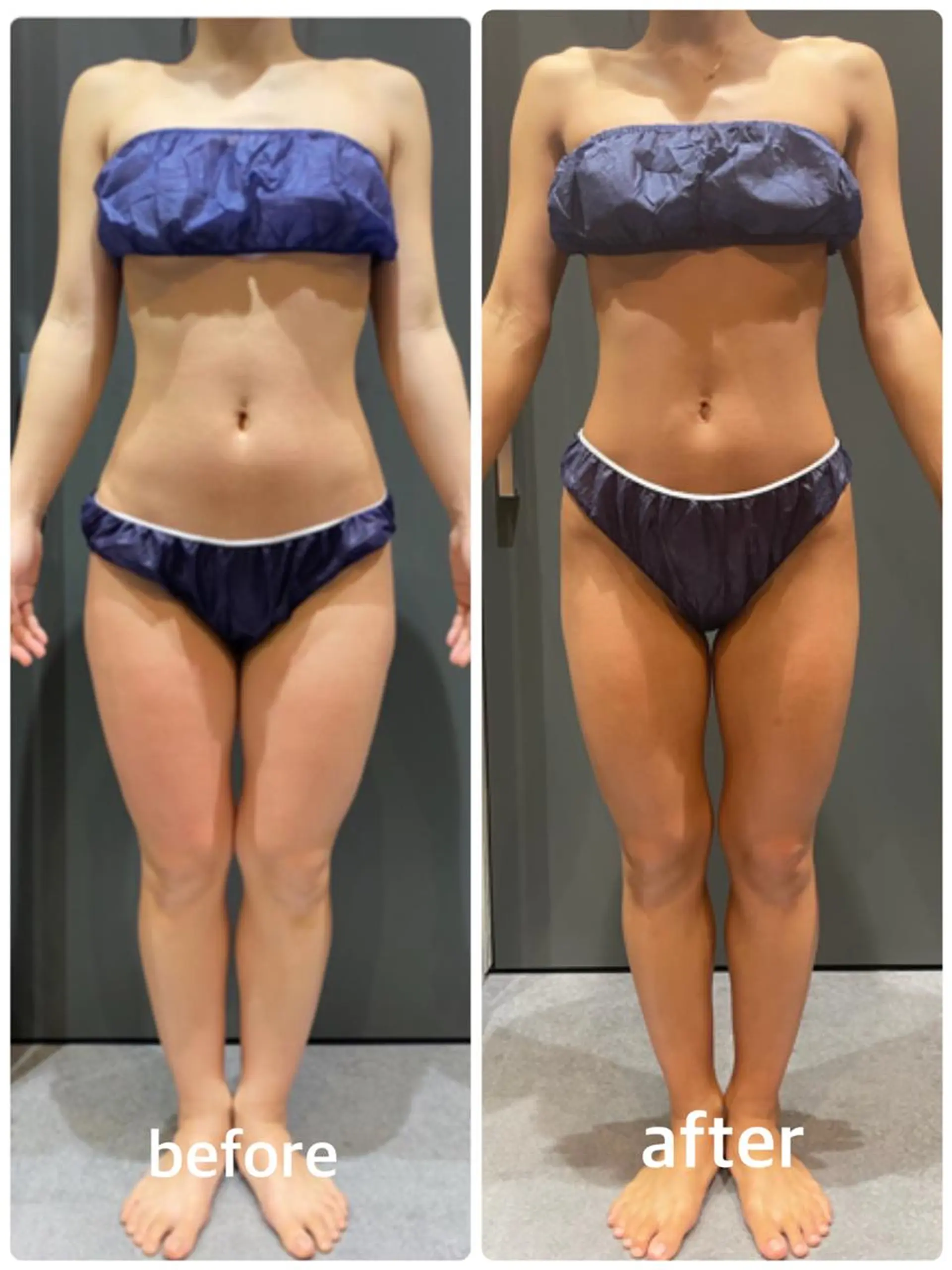 エステ リラク 🤍Linola🤍 レイビス　須藤のエステ・リラクイメージ