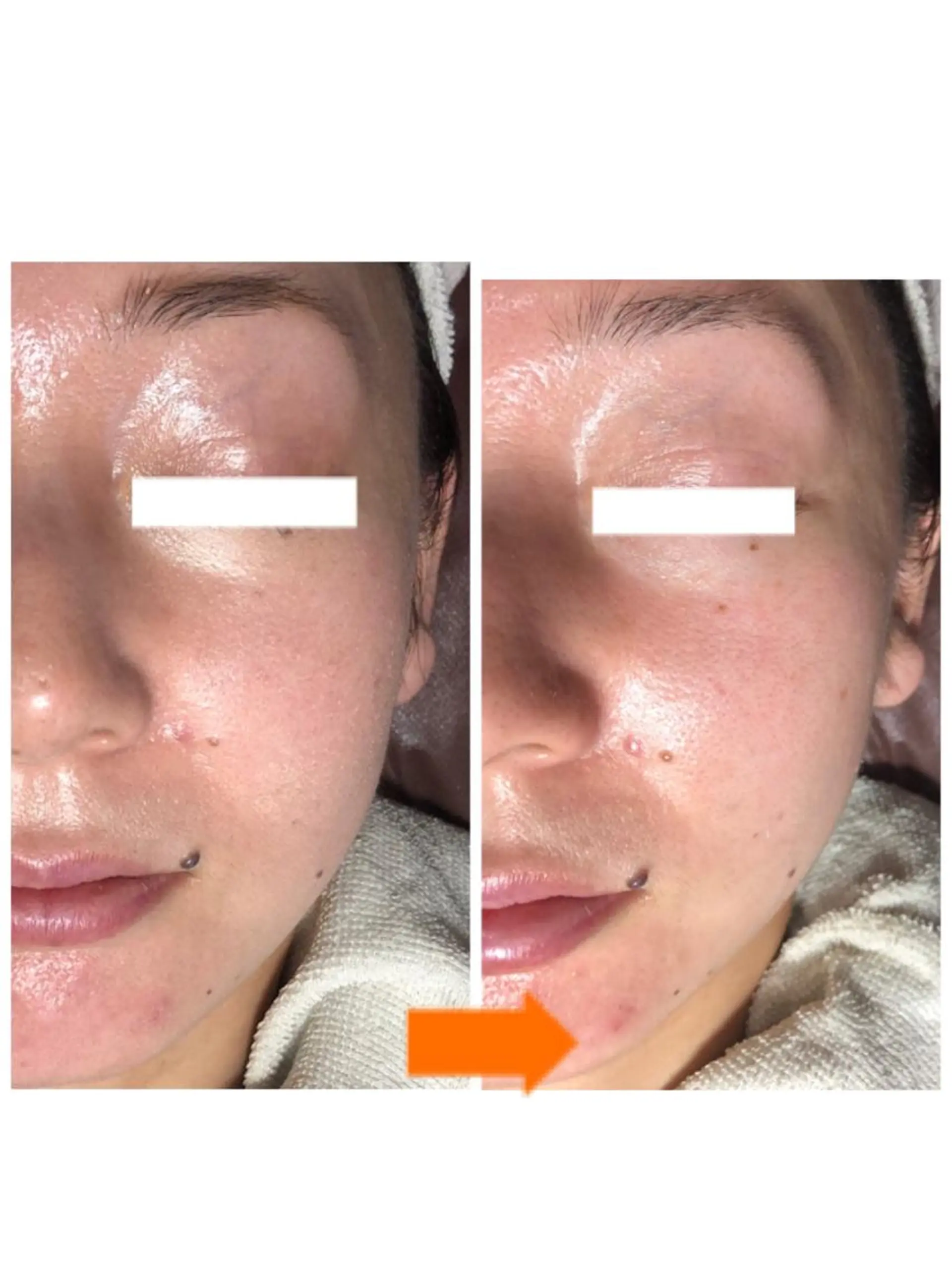 エステ 小顔・毛穴・たるみ ネイル　似内真樹のエステ・リラクイメージ