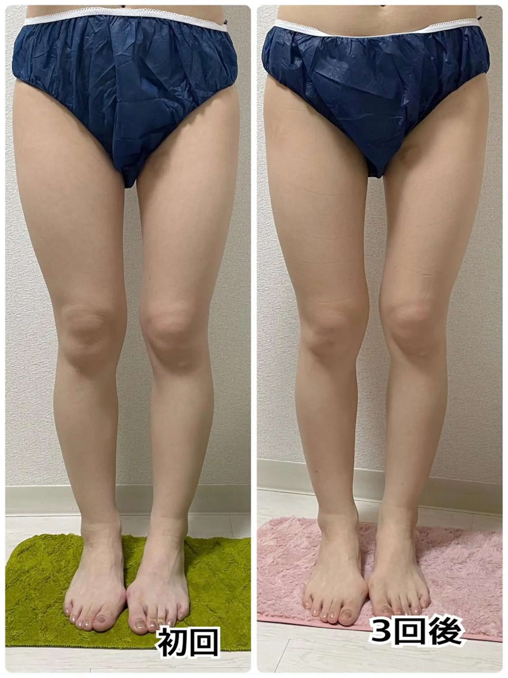 エステ 古山 由美子のその他イメージ