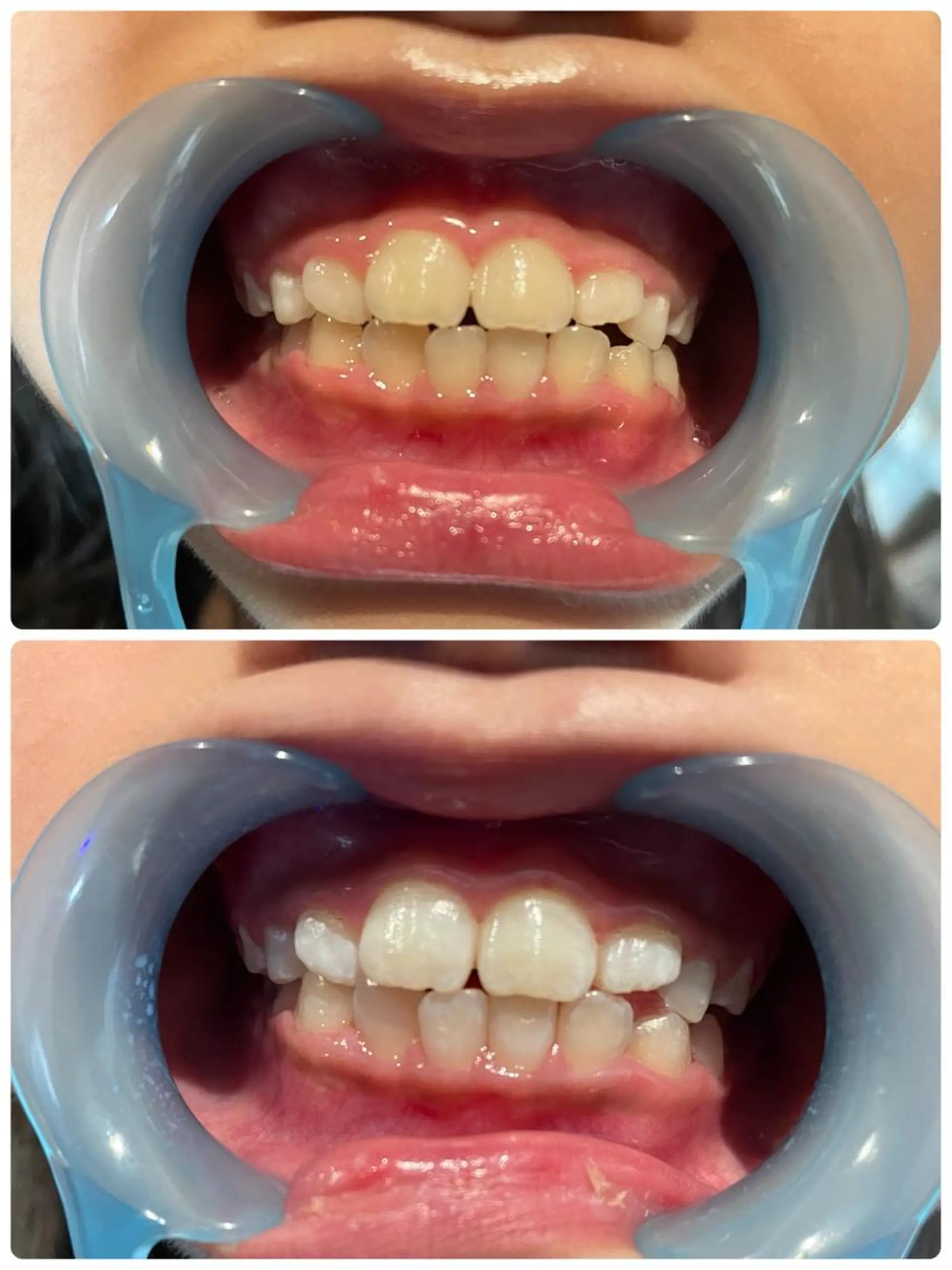 その他 エステ／ネイル/脱毛 R.Msalonのネイルデザイン