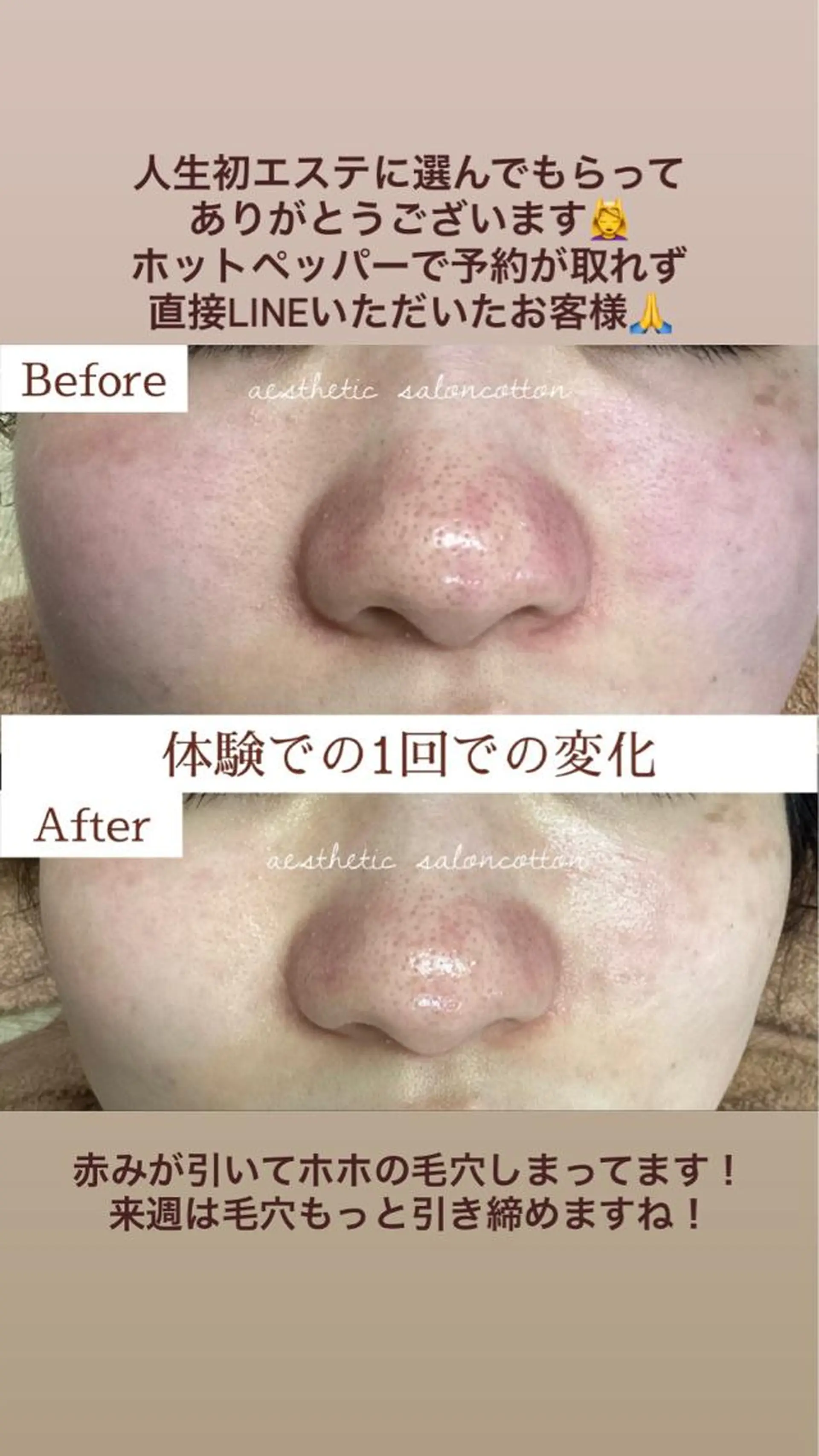 エステ 都度払い 肌質改善専門サロンのエステ・リラクイメージ