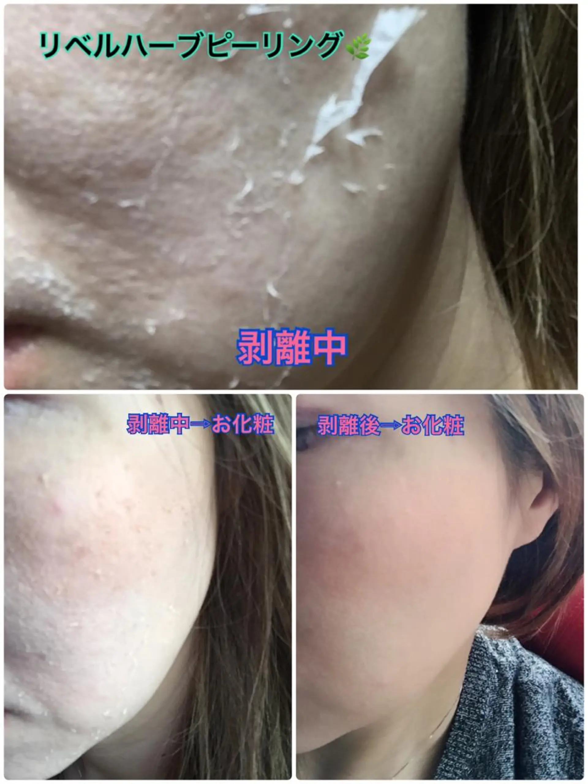 エステ 【リベルハーブピーリング認定店】敏感肌・美白脱毛専門店Dione立川店所属・Dione 立川店のエステ・リラクイメージ