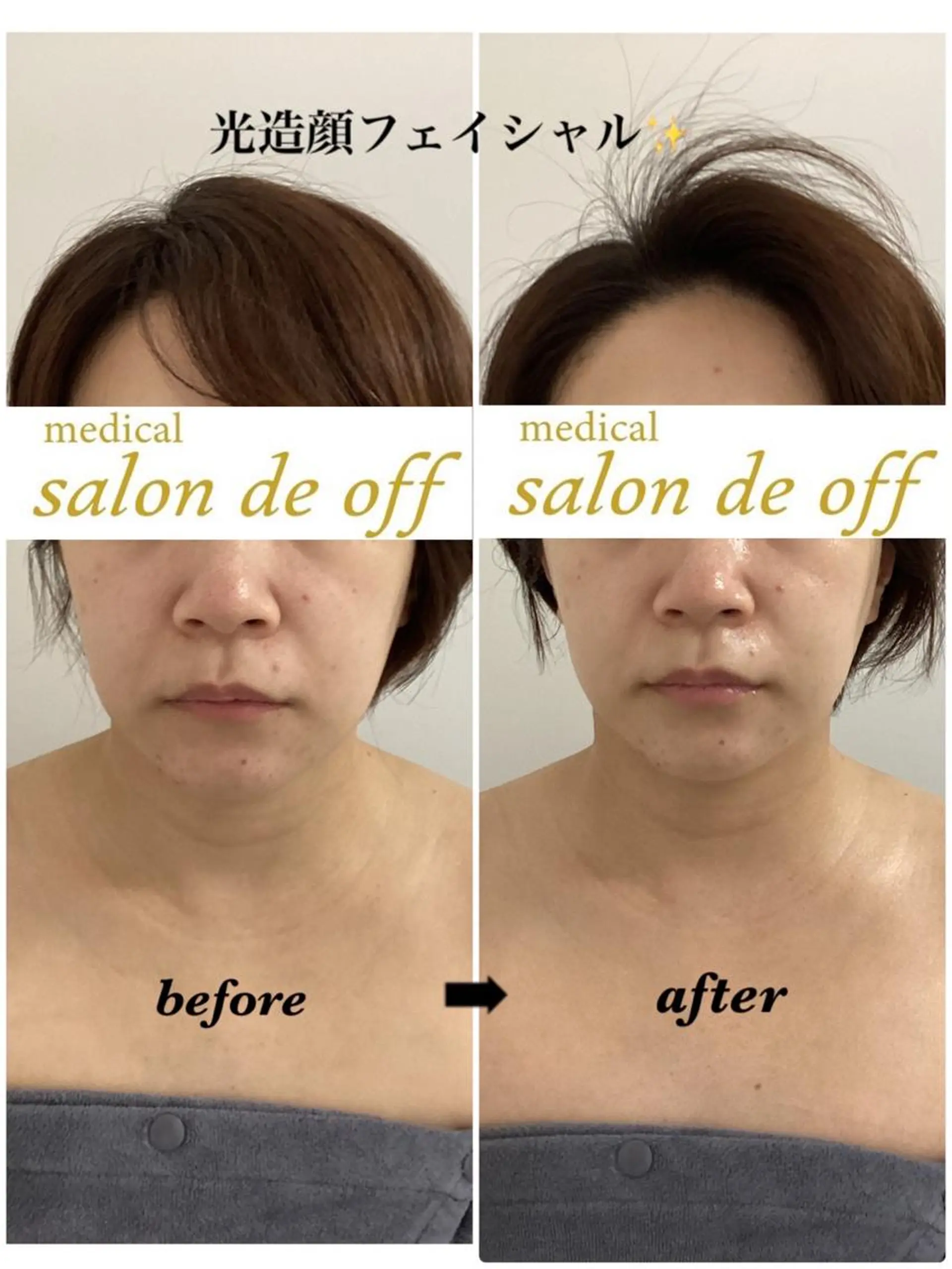 エステ リラク 🩵Tatsumi Kana🩵のエステ・リラクイメージ