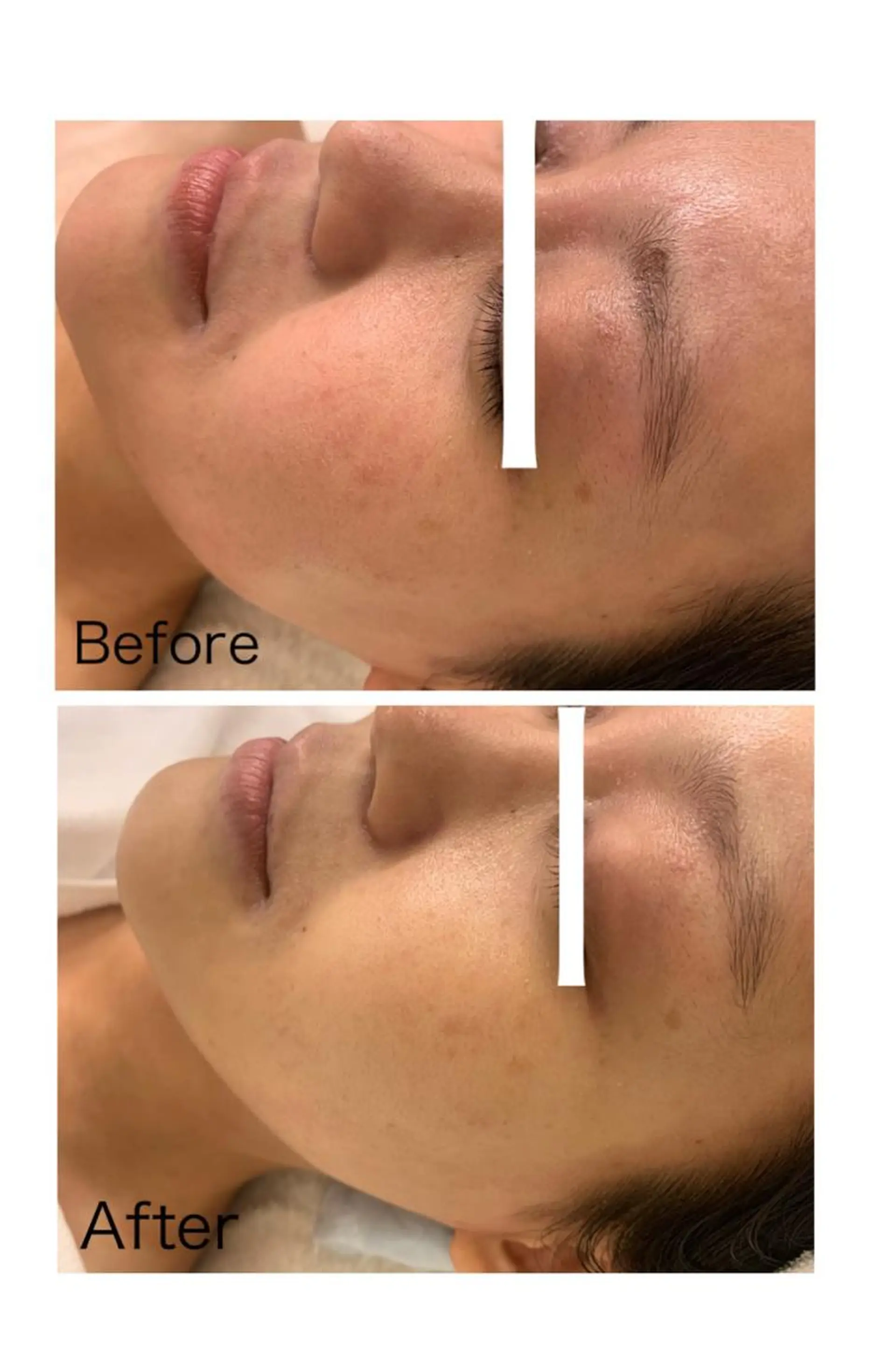 肌質改善/ツヤ肌作り /松本杏奈のエステ・リラクイメージ