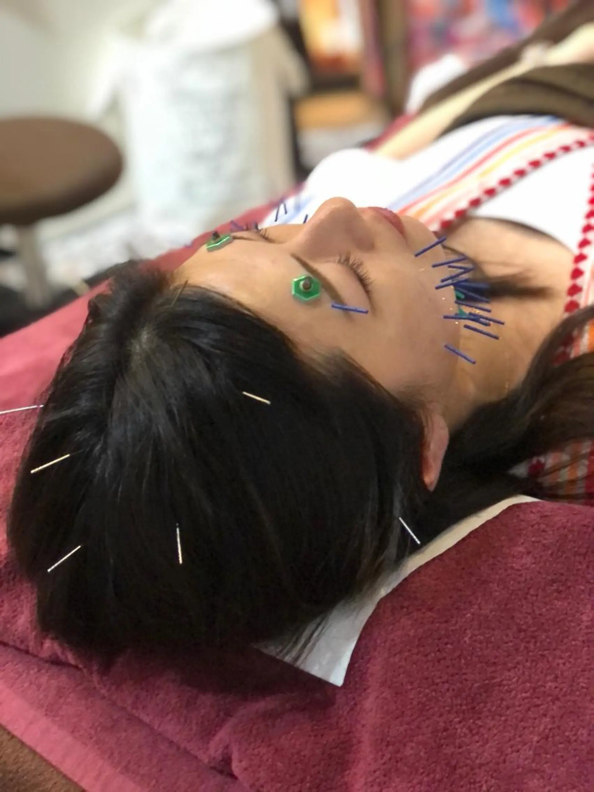 エステ リラク 美容鍼灸女性専用 りんご鍼灸治療院のその他イメージ