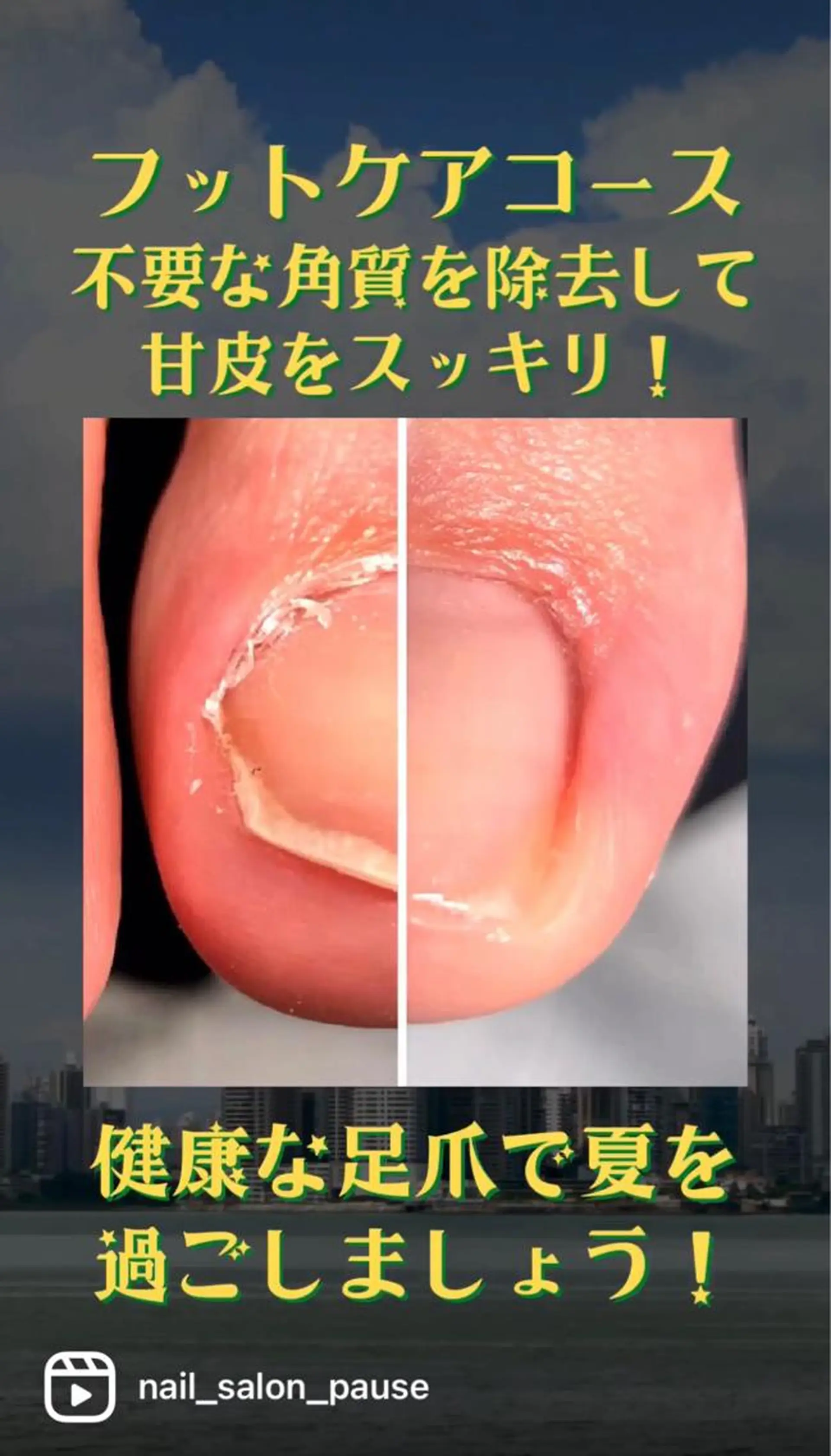 ネイル アートネイル フットネイル ジェルネイル その他(ネイル) プライベートネイルサロンPause(ポーズ)所属・自爪育成ネイルサロン Pause(ポーズ)のネイルデザイン