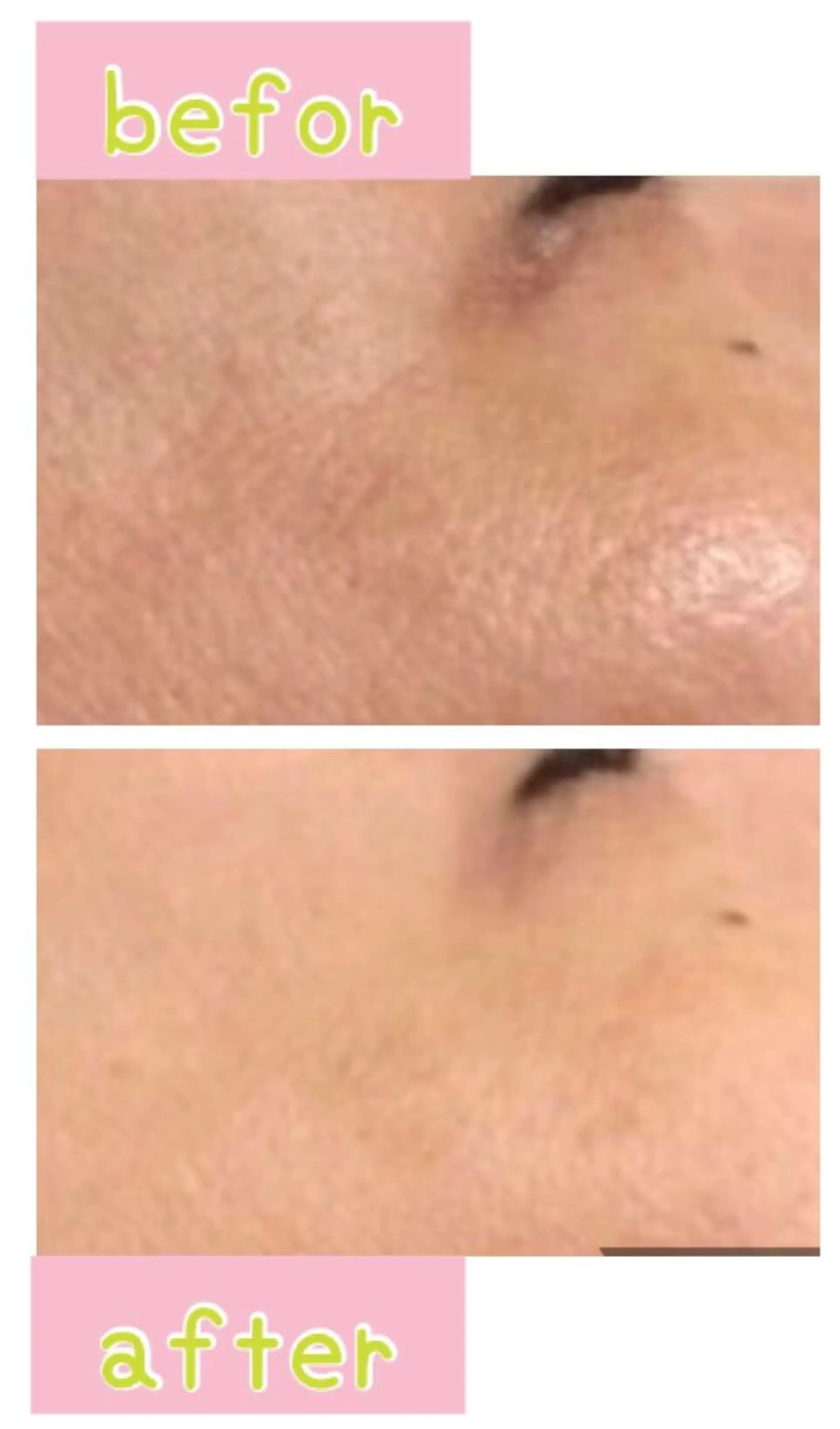 エステ 癒し腸もみサロン シャユーム　ゆきなのエステ・リラクイメージ