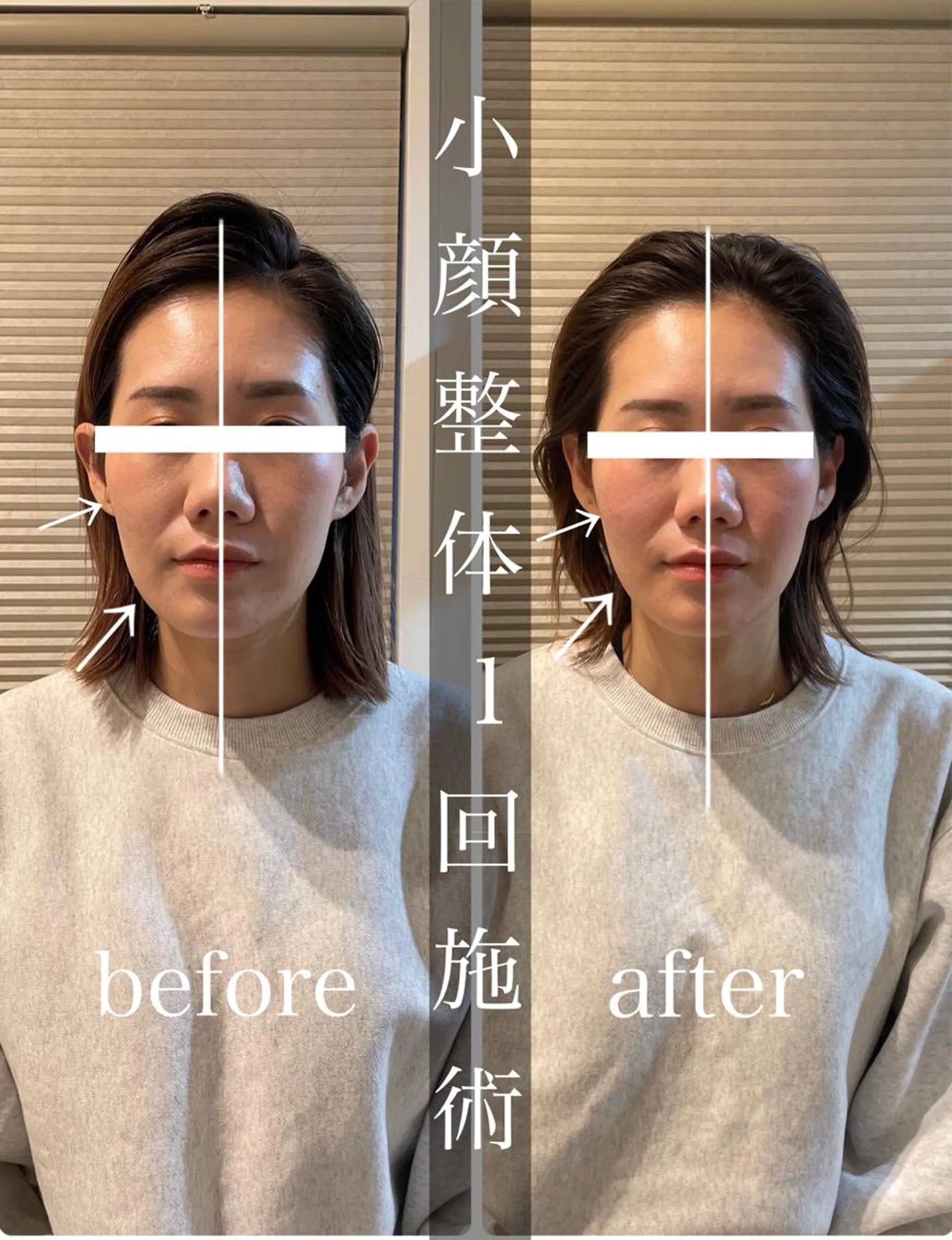 鍼灸 Refineのその他イメージ