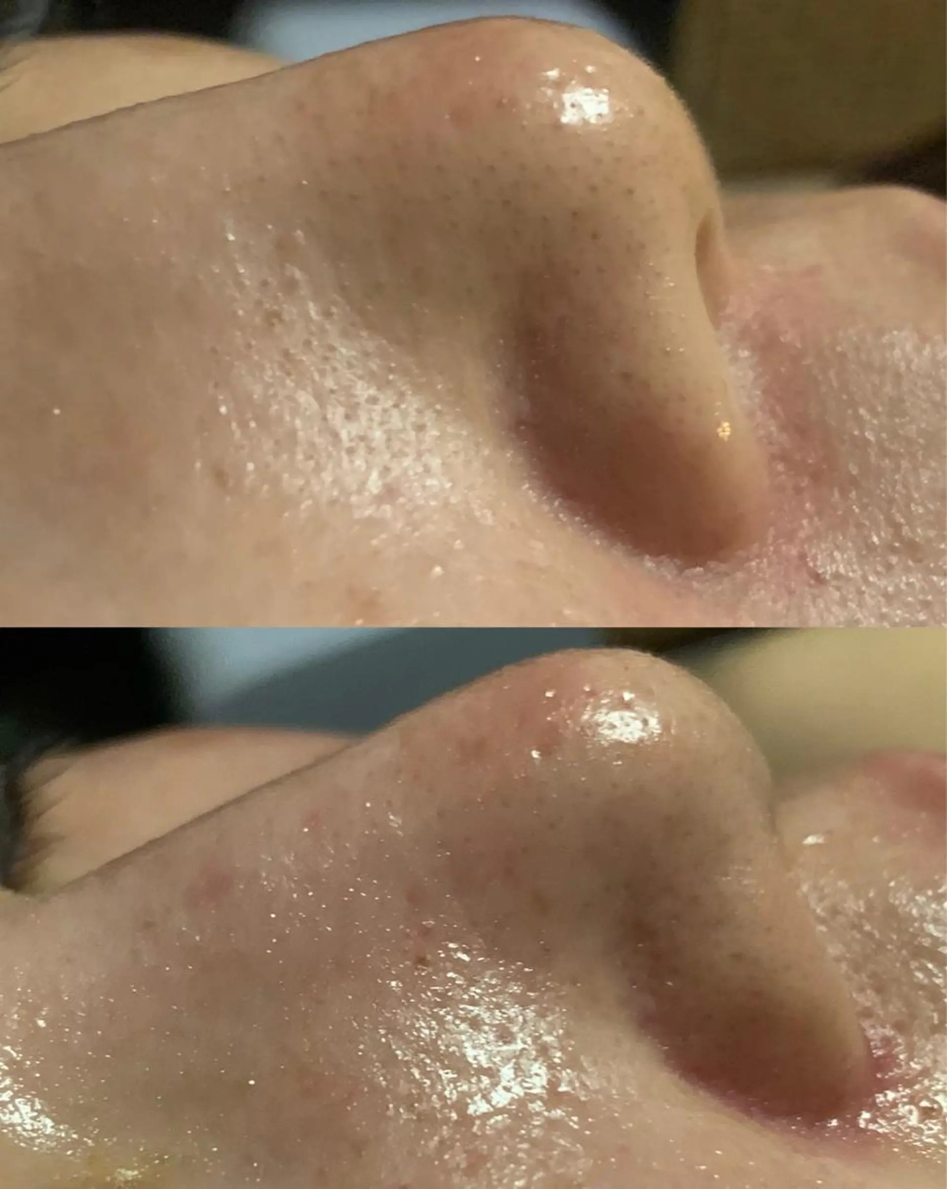 lymph care 'Welnəsのエステ・リラクイメージ