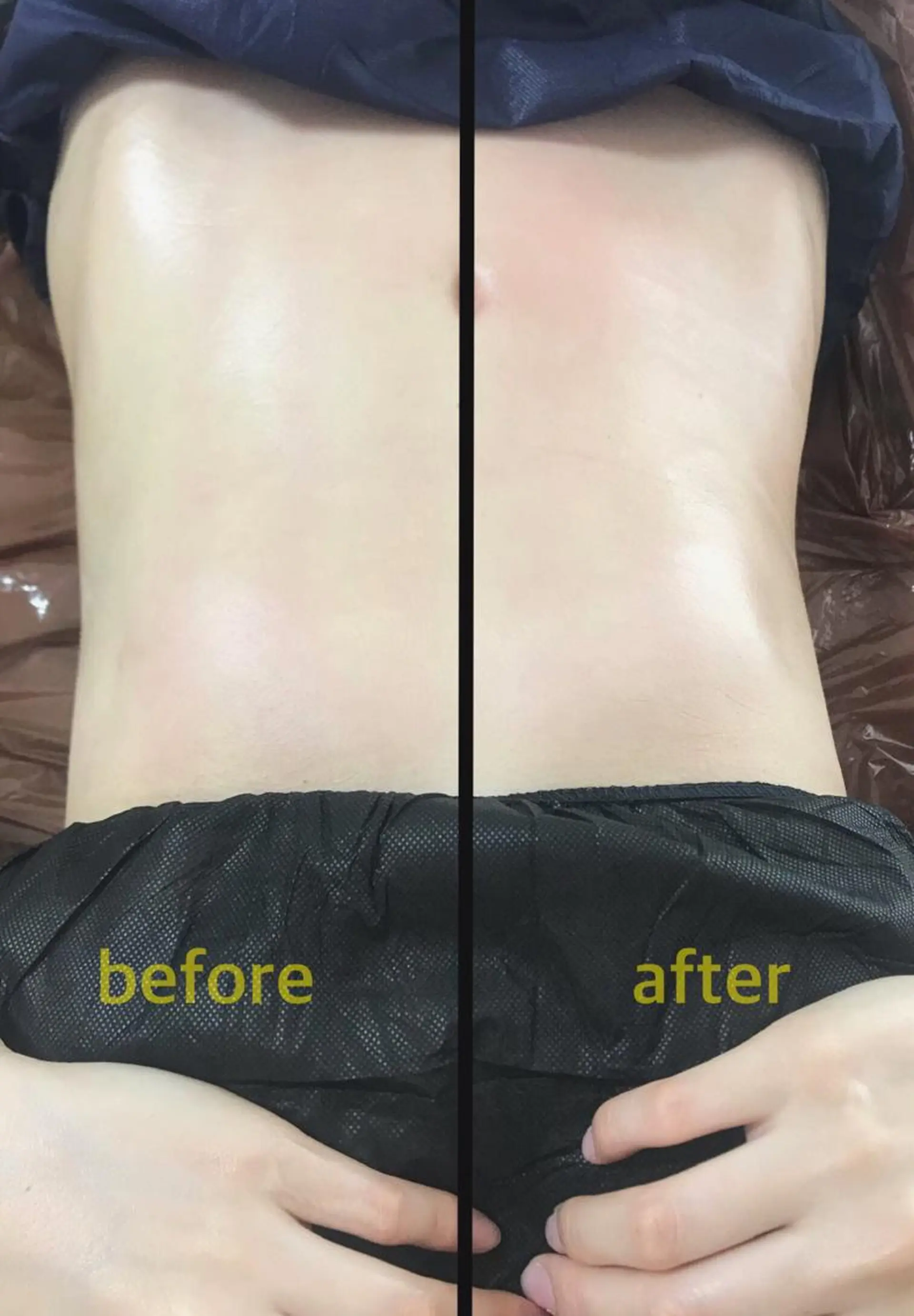 《本気痩せ×疲労改善 》  BILOOPのエステ・リラクイメージ