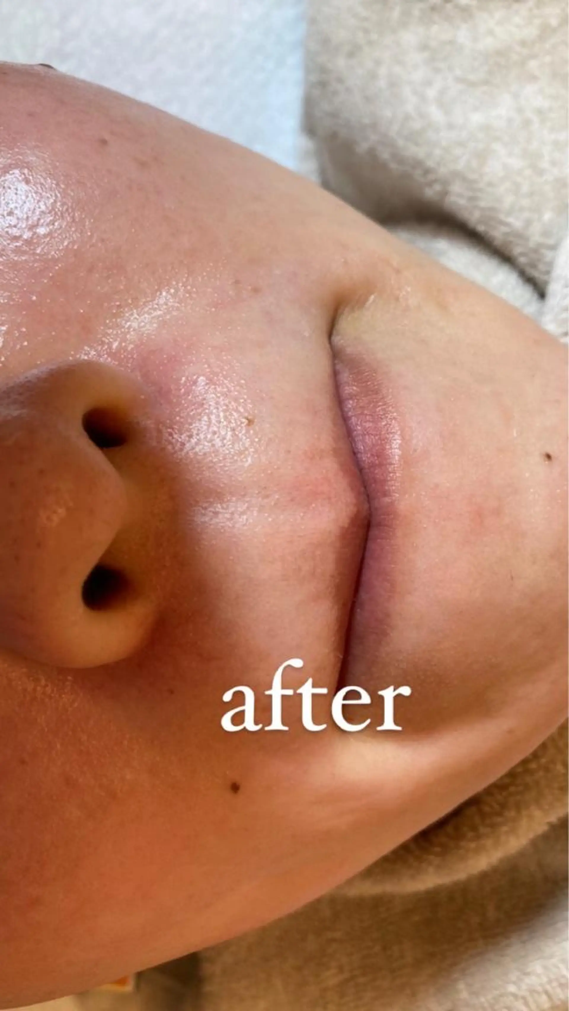 脱毛 Le cherien ルシェリアのエステ・リラクイメージ