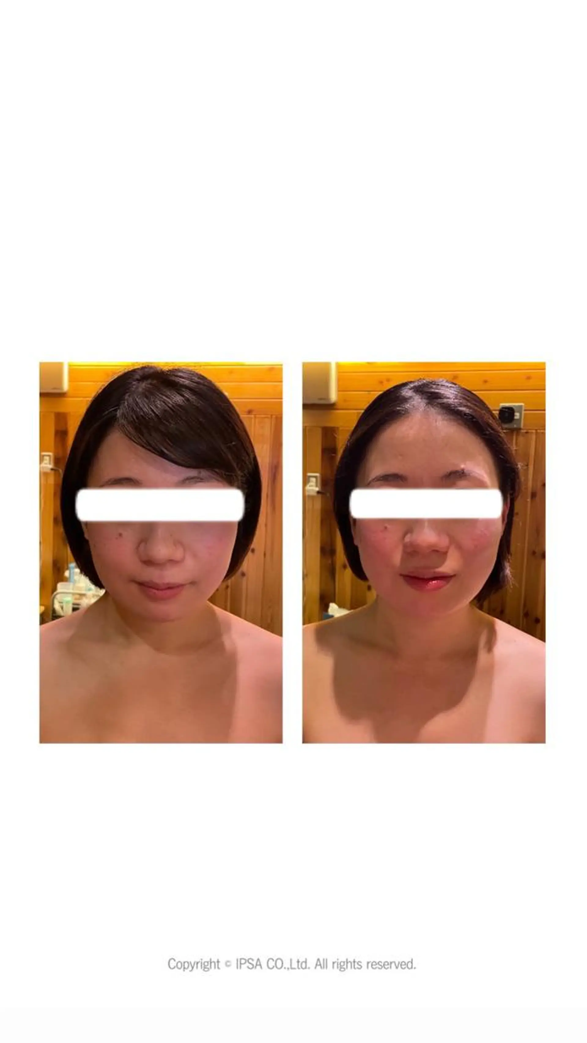 エステ リラク BACI STYLE所属・寧♡ 美肌小顔・ボディケアのエステ・リラクイメージ