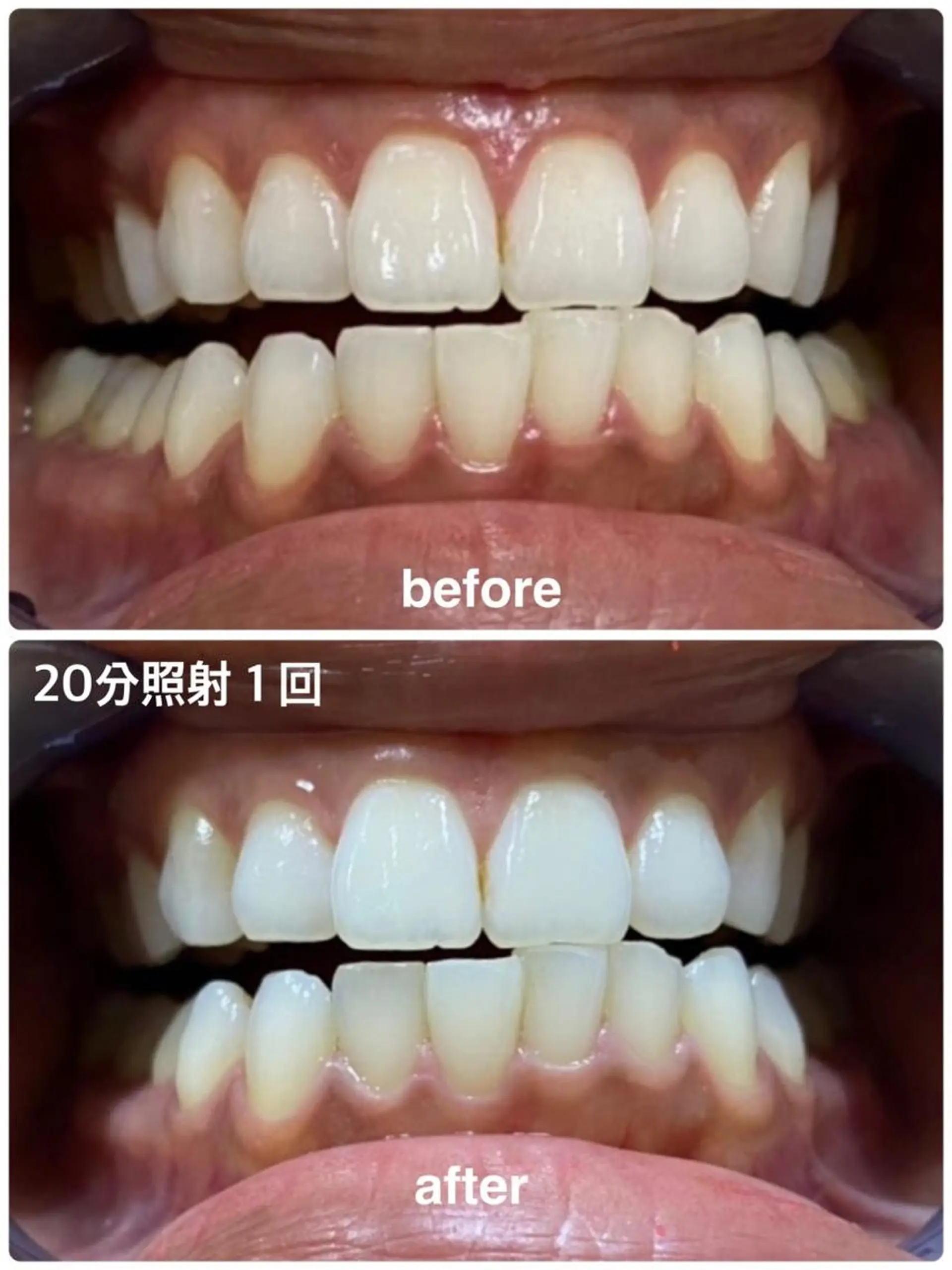 その他 ホワイトニングジム 池袋のその他イメージ