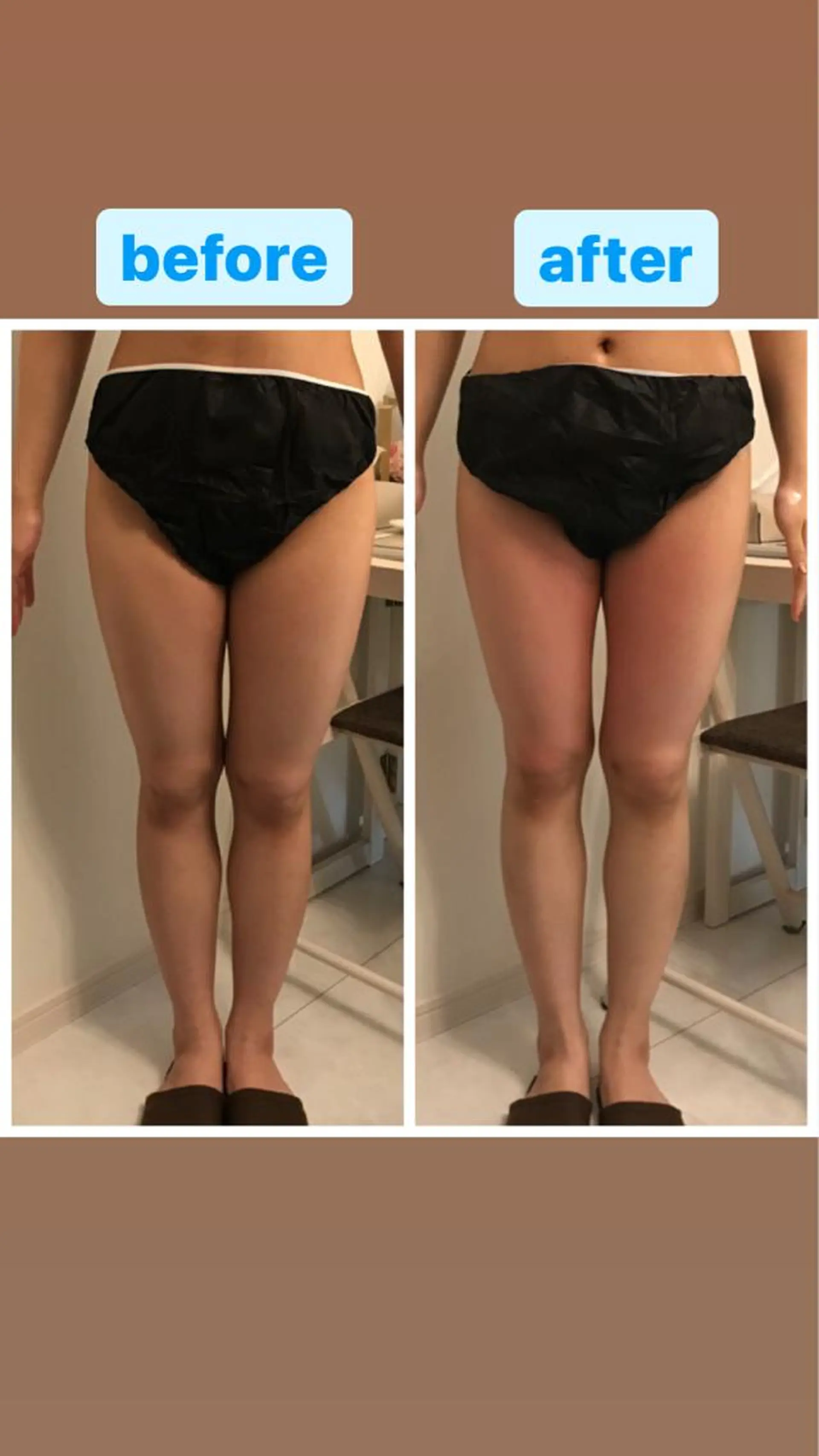 エステ 佐藤 加奈のエステ・リラクイメージ