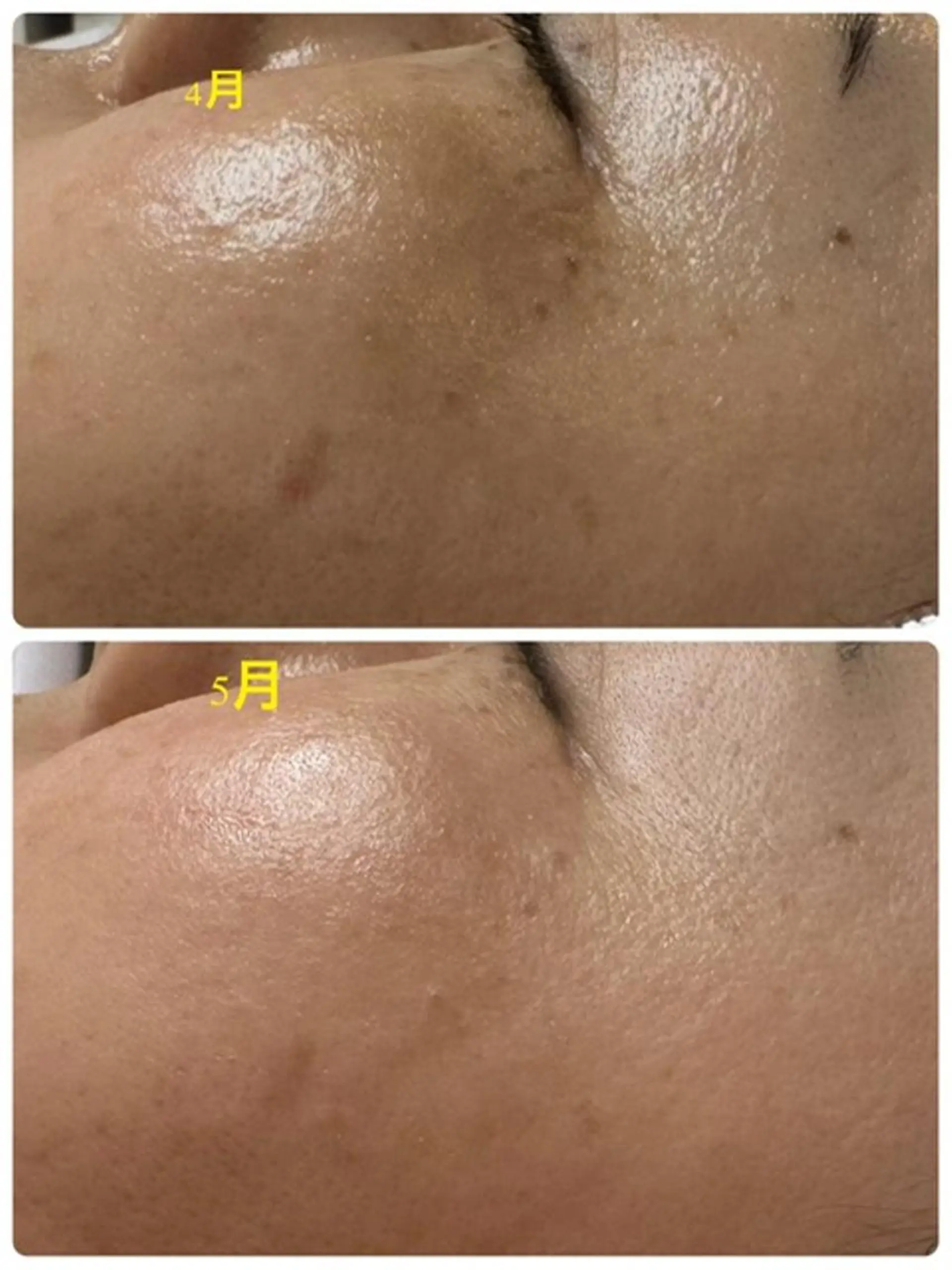 Lien オーナー　山口智嘉のエステ・リラクイメージ