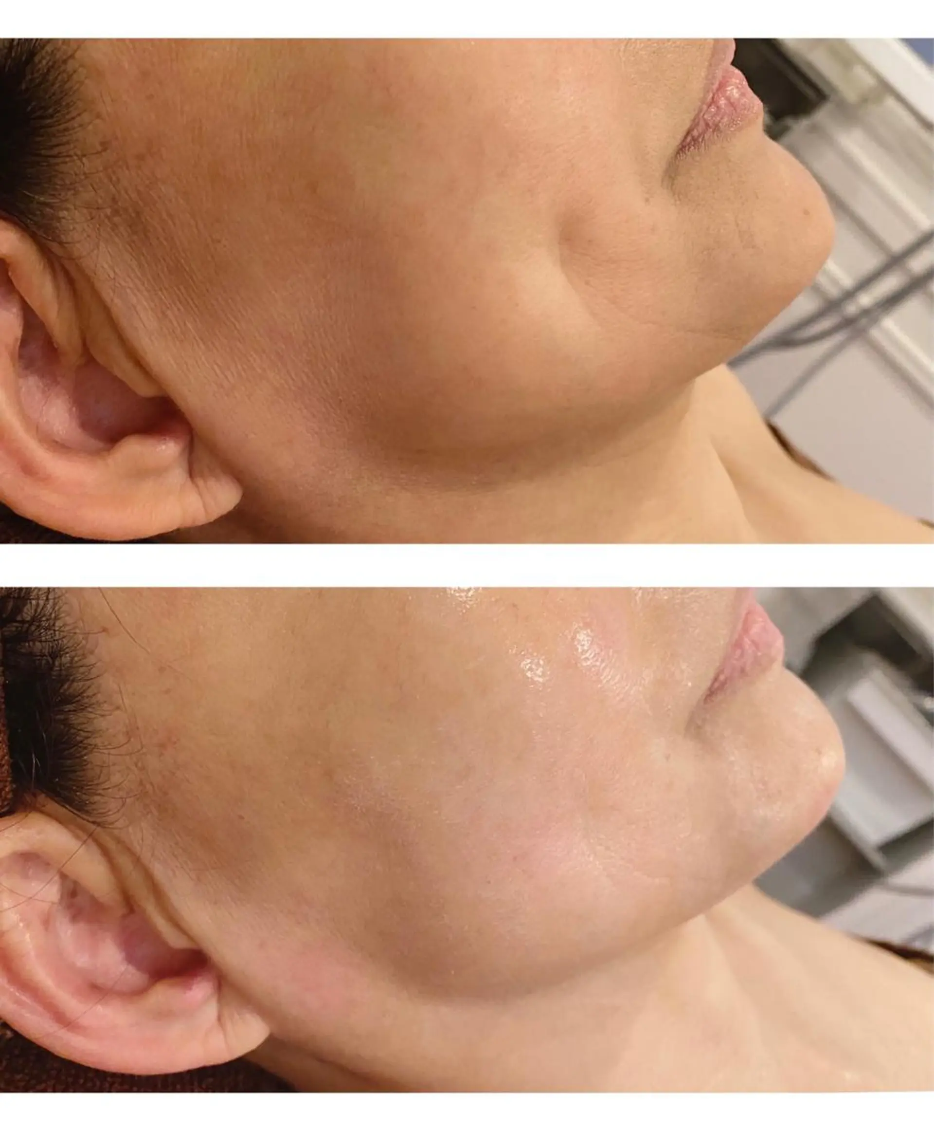 小顔EX心斎橋 REVIハーブのエステ・リラクイメージ