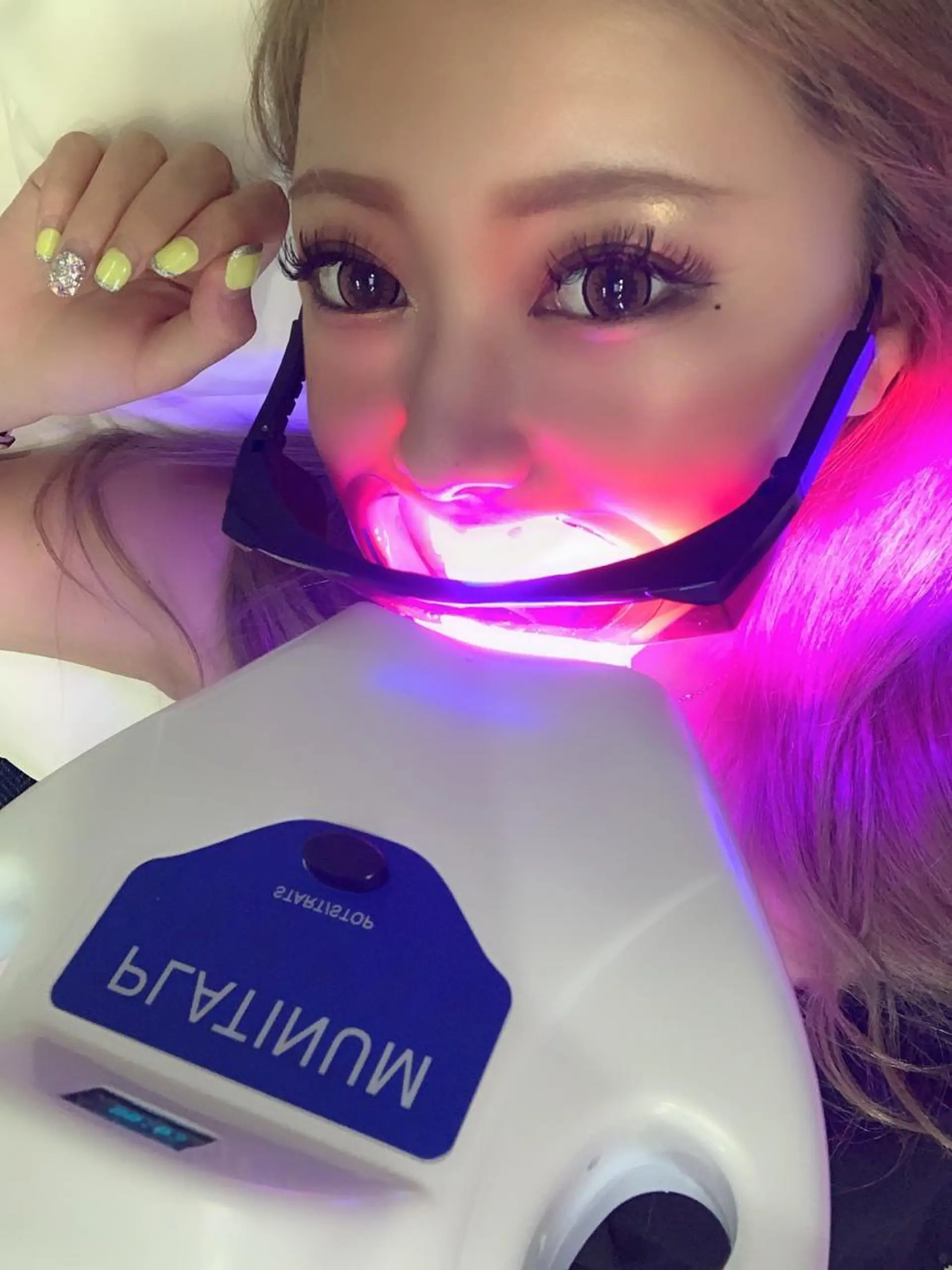 ホワイトニングサロン CREWのその他イメージ