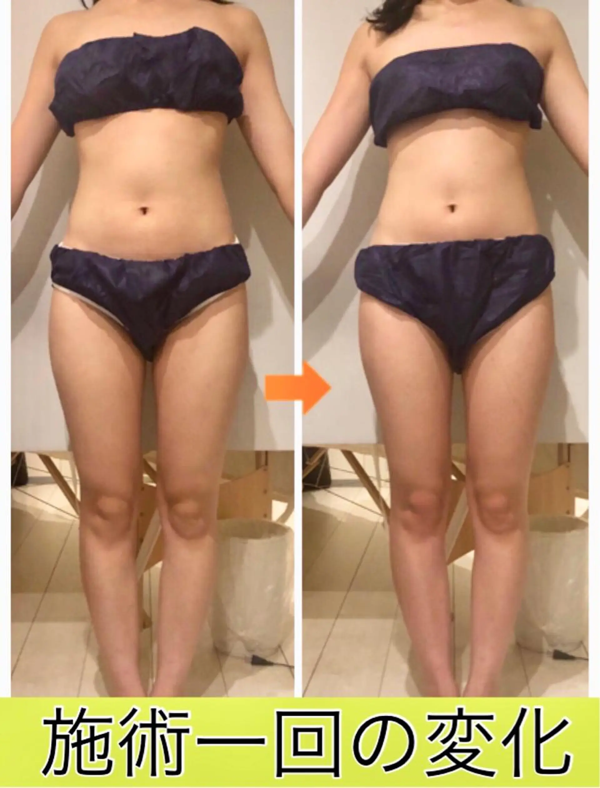 ロング カラー パーマ ヘアアレンジ メンズ キッズ ネイル マツエク・マツパ ‍痩身＆ボディ 結果出し🌟丹野のエステ・リラクイメージ