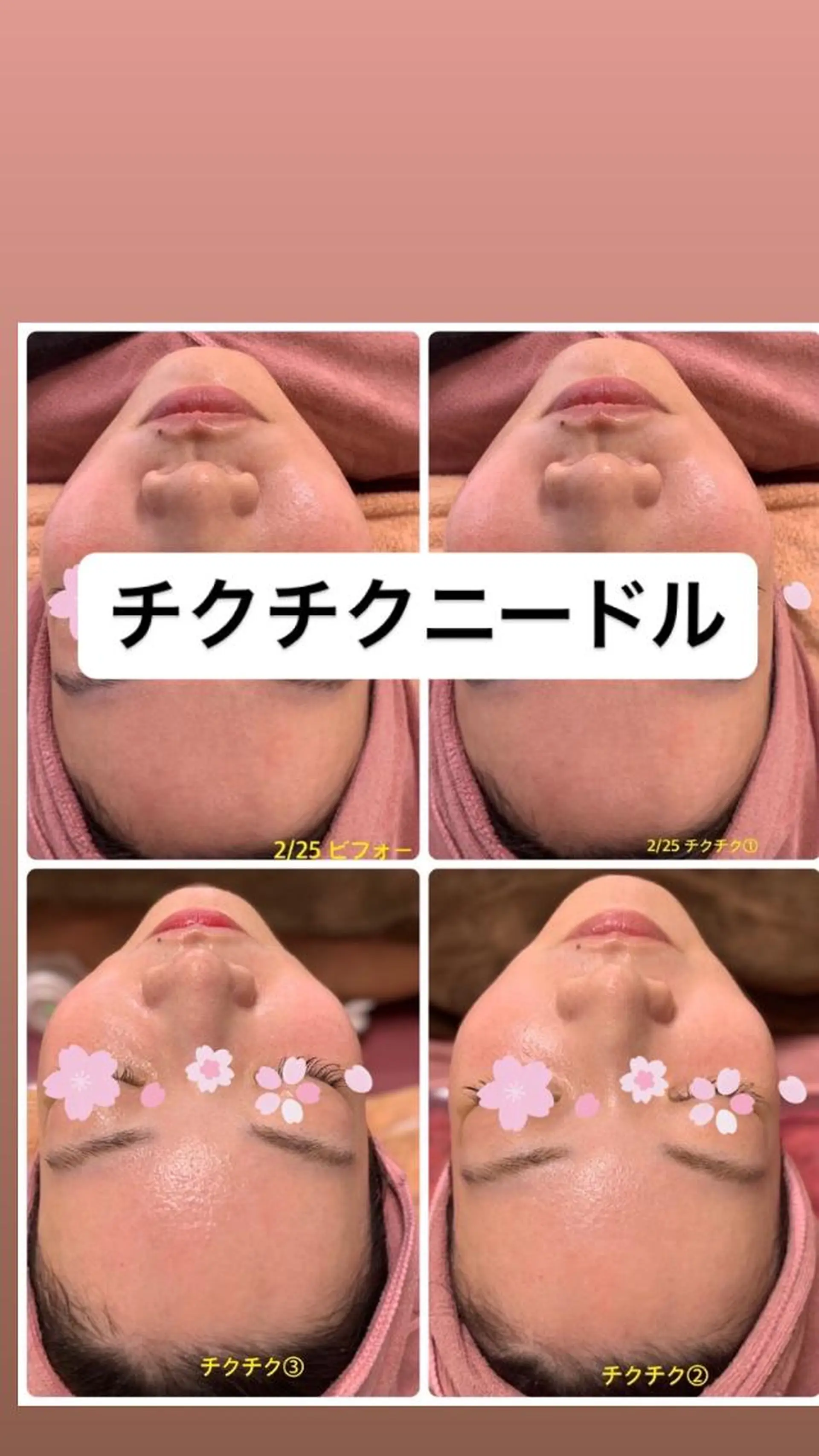 Lien オーナー　山口智嘉のエステ・リラクイメージ