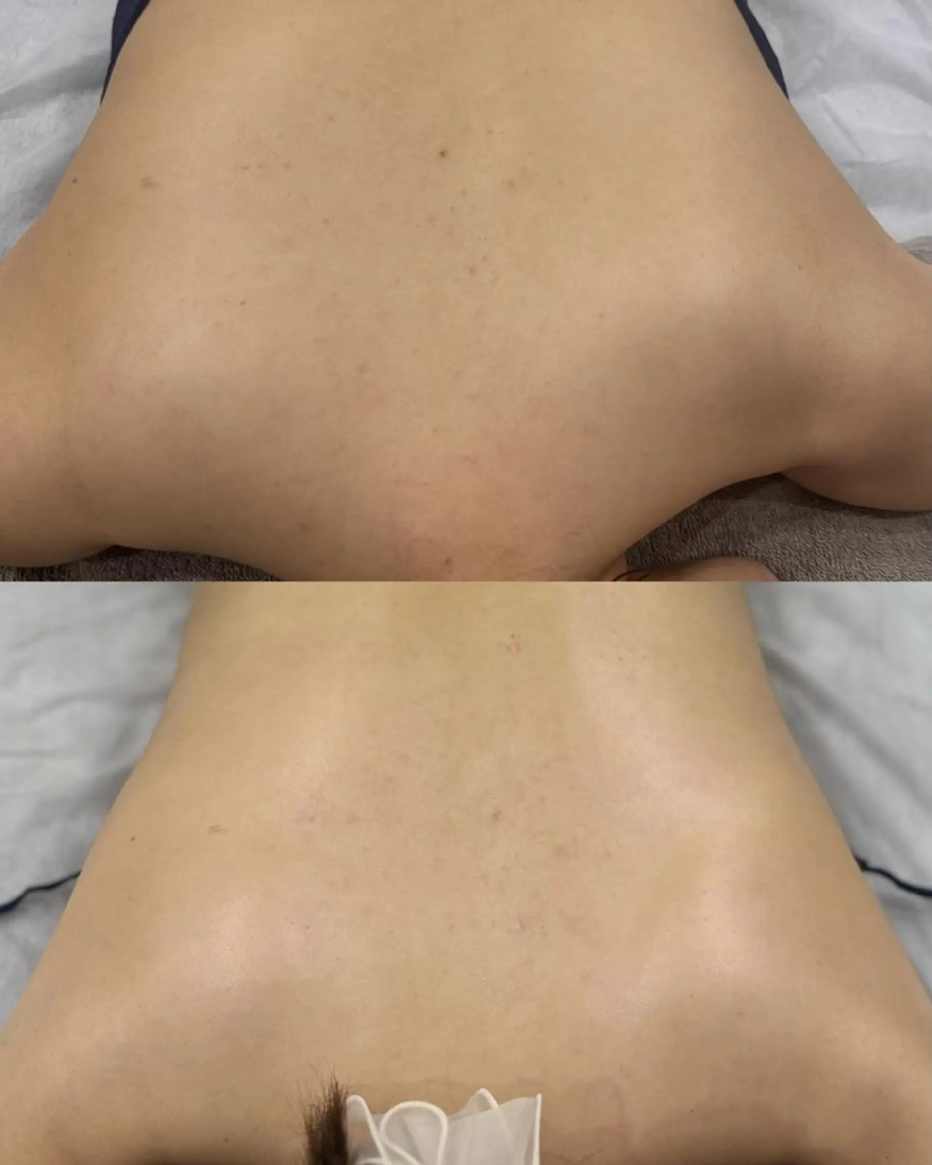 心斎橋🤍堀江.小顔 ハーブ.痩身クレビアのエステ・リラクイメージ