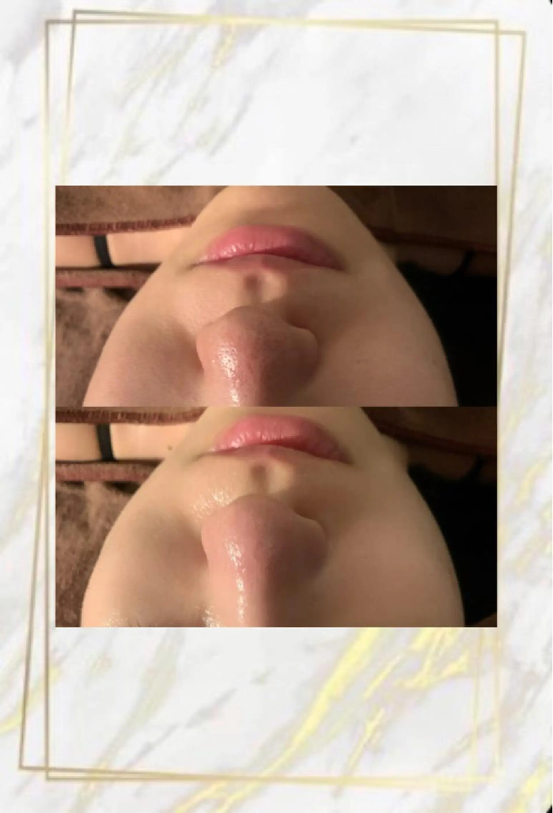 その他 ハーブピーリング特選 認定rebirthのエステ・リラクイメージ