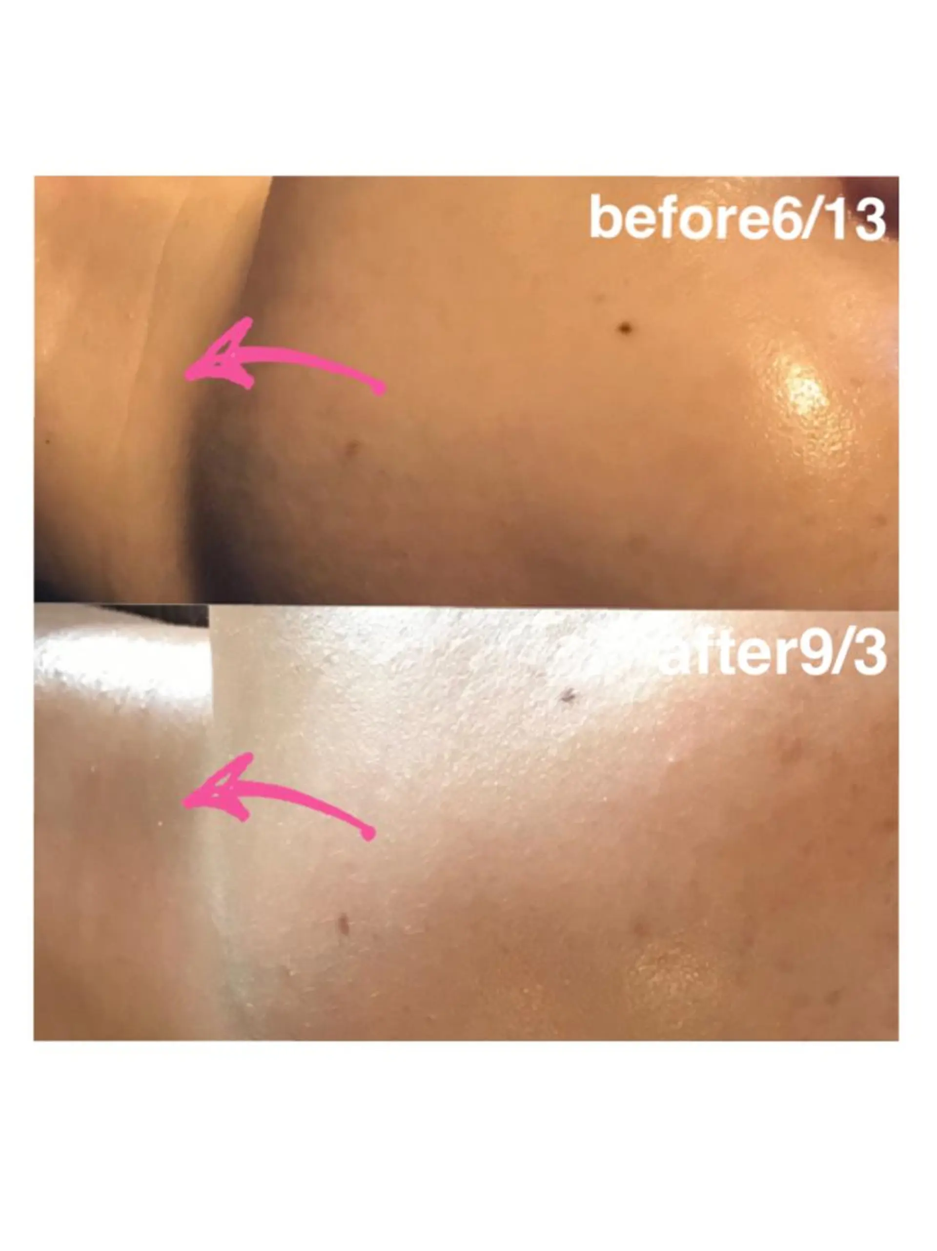 エステ 浜野 恵美のエステ・リラクイメージ