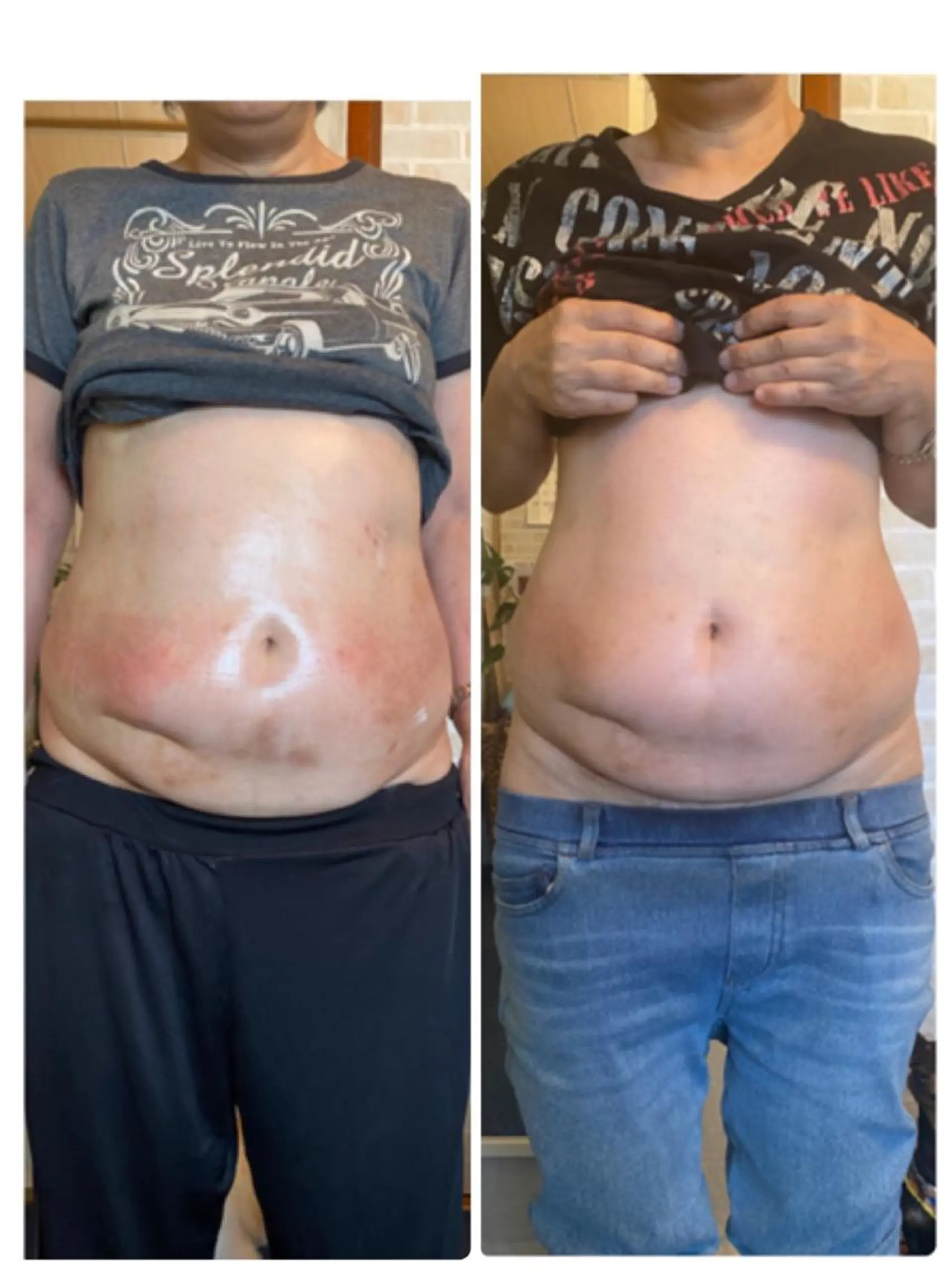 ミリ ミリのエステ・リラクイメージ