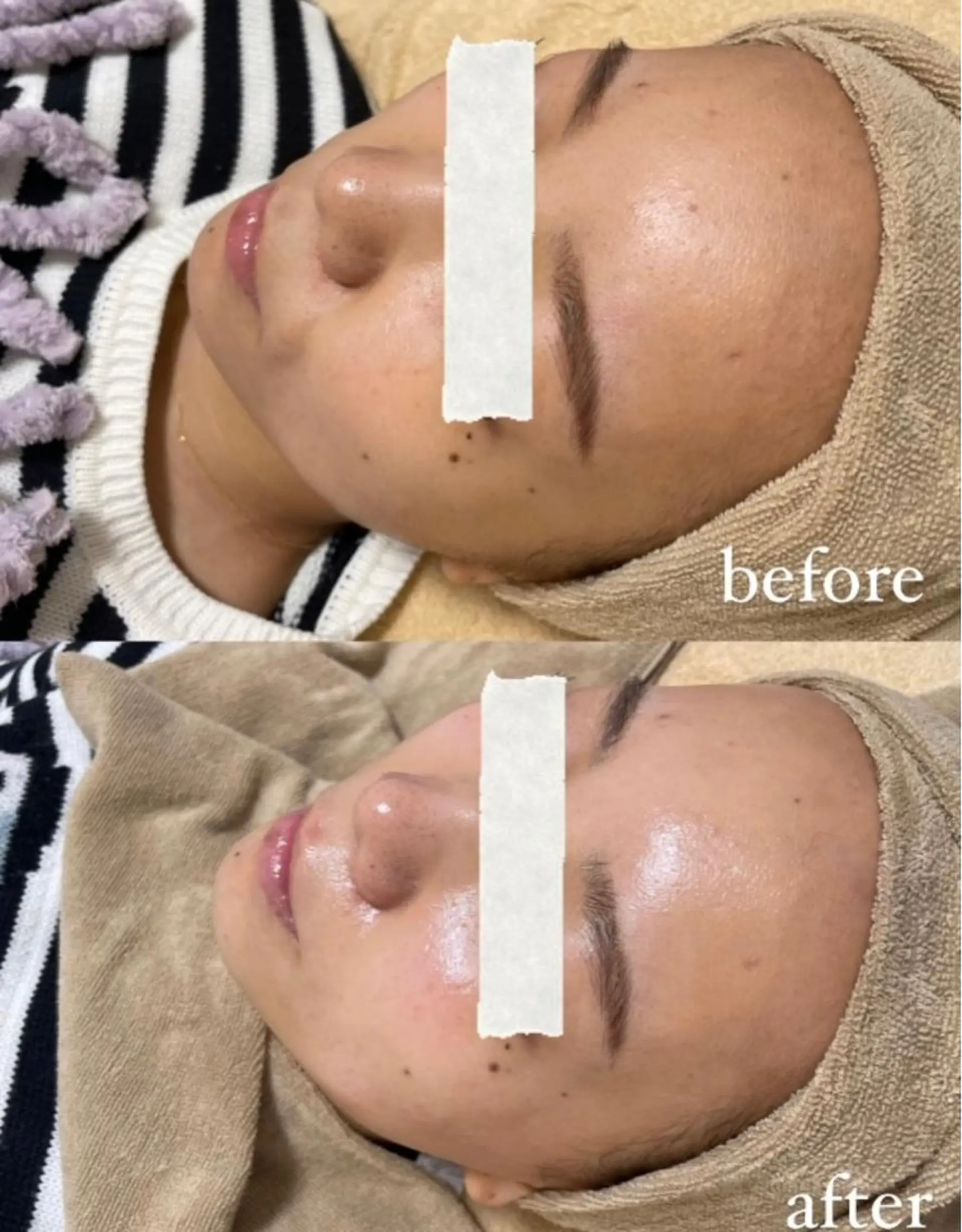 エステサロン Mi-mi.iのエステ・リラクイメージ