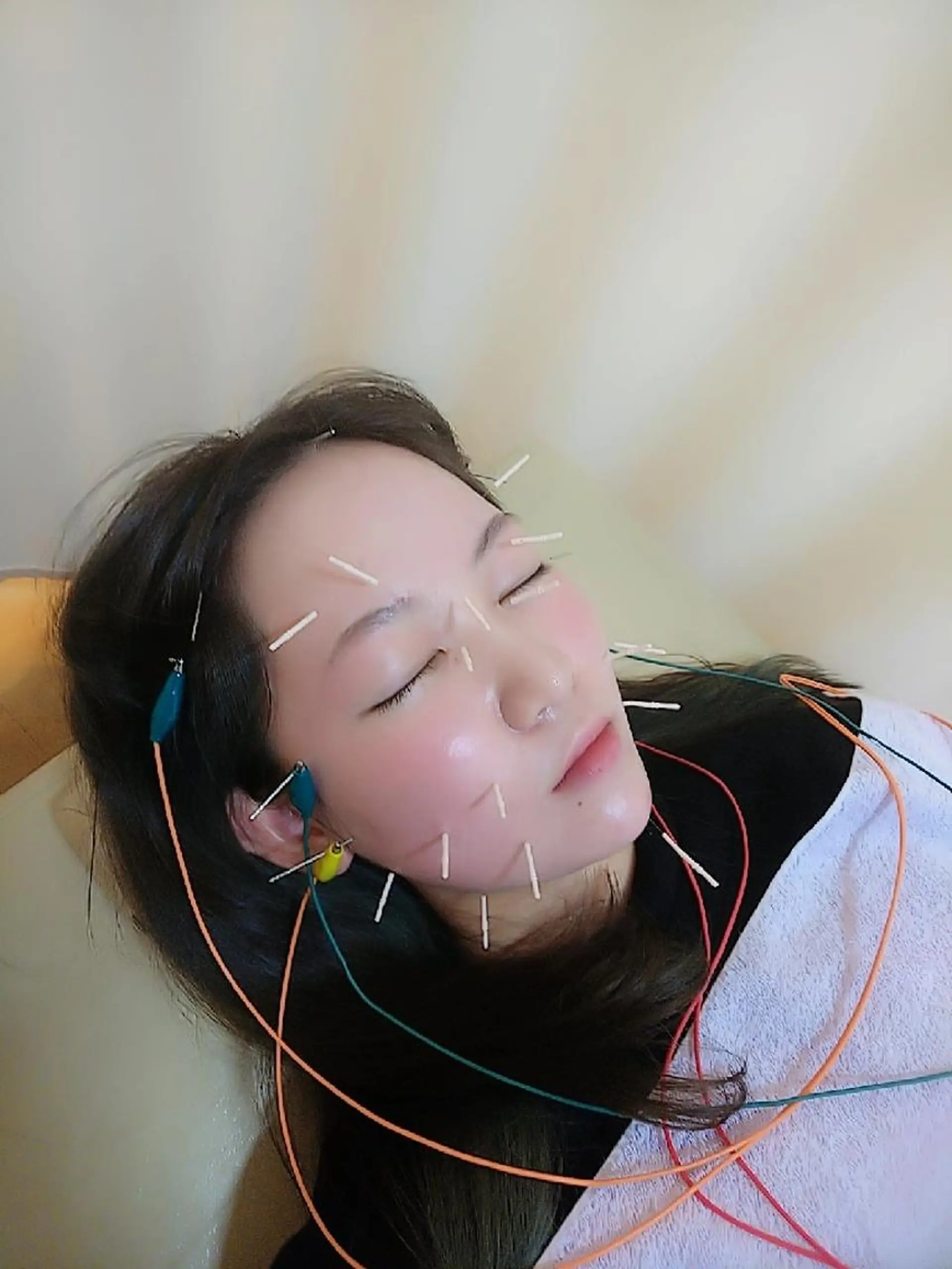 エステ リラク お顔のむくみたるみ 専門☆美容鍼小顔矯正のエステ・リラクイメージ