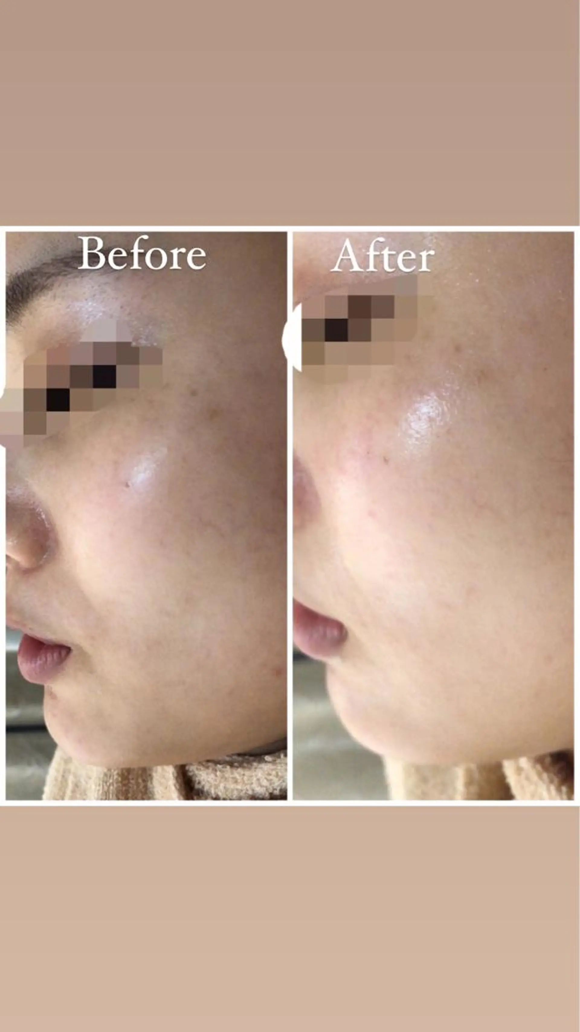 ロング カラー パーマ ヘアアレンジ メンズ キッズ ネイル マツエク・マツパ Amaryllis 🌹のエステ・リラクイメージ