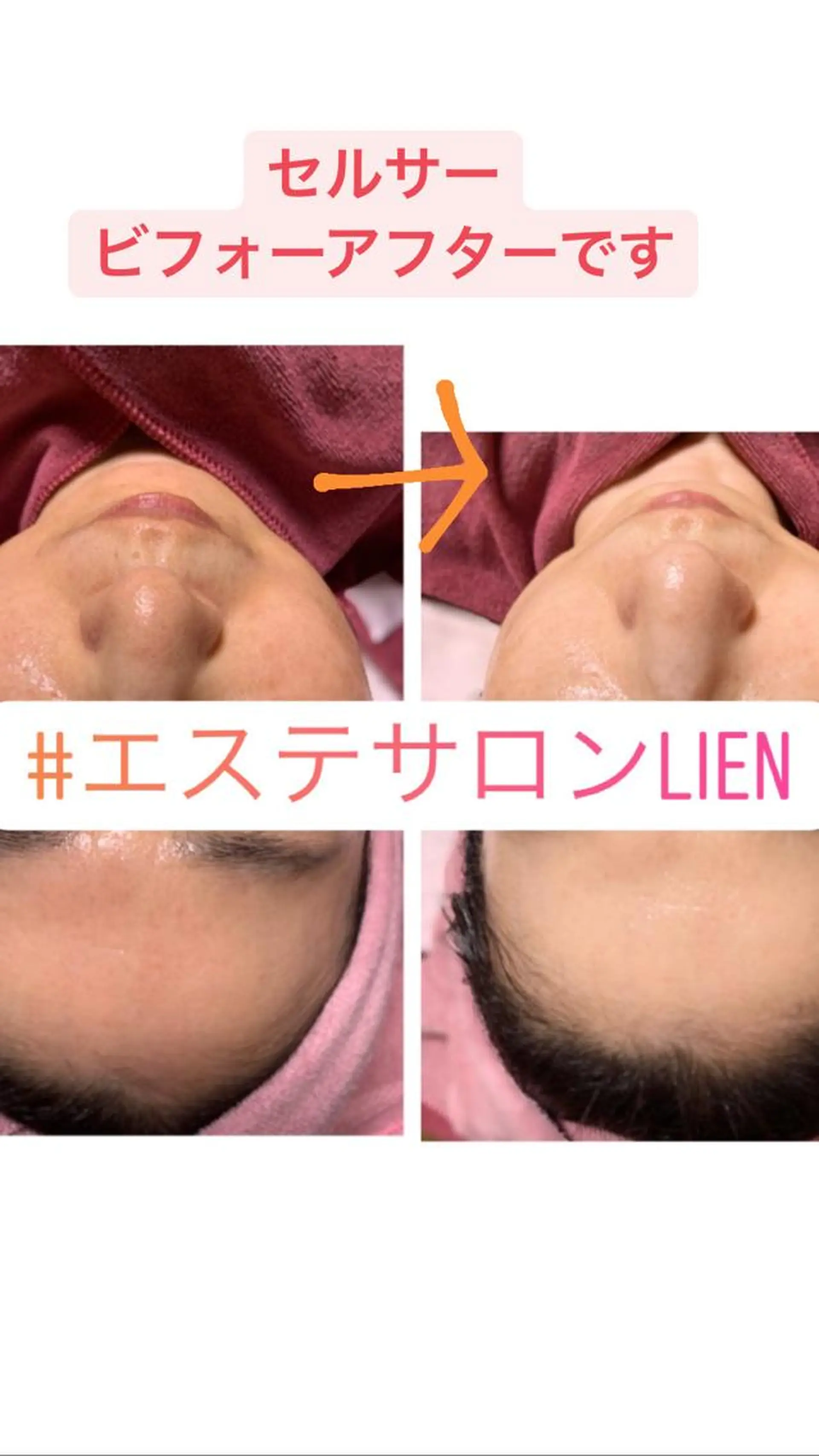 エステ Lien オーナー　山口智嘉のエステ・リラクイメージ