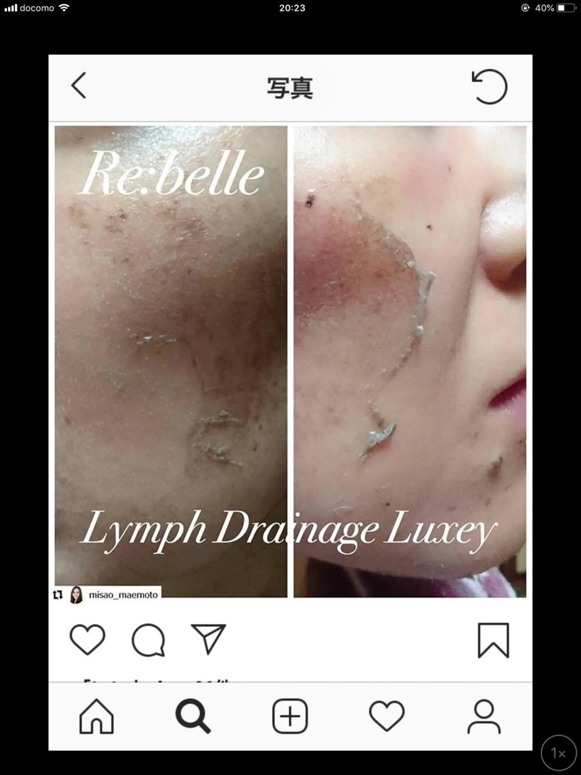 エステ 【リベルハーブピーリング認定店】敏感肌・美白脱毛専門店Dione立川店所属・Dione 立川店のエステ・リラクイメージ