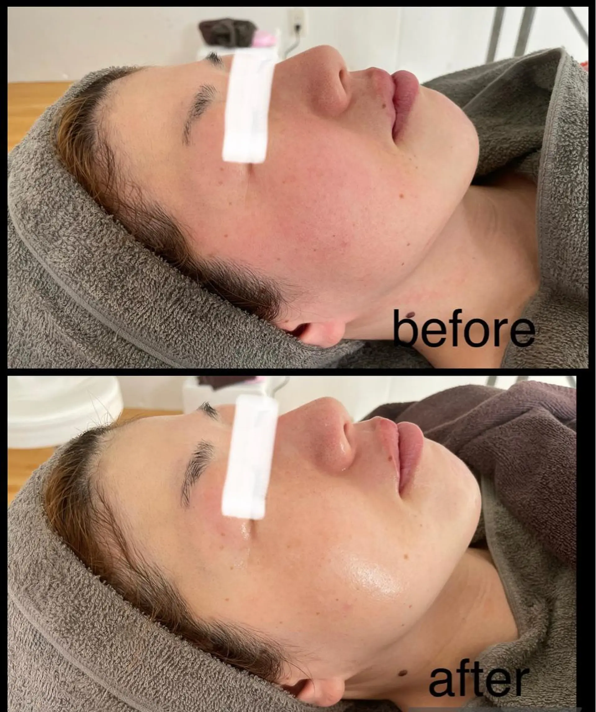 エステ Lavi&所属・肌質改善サロン Lavi&のその他イメージ