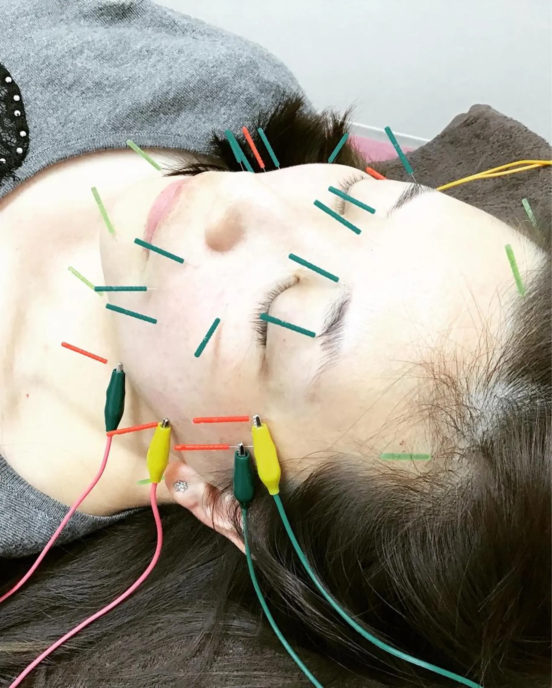 エステ リラク まごころ鍼灸整骨院所属・まごころ鍼灸整骨院 京王堀之内院のエステ・リラクイメージ