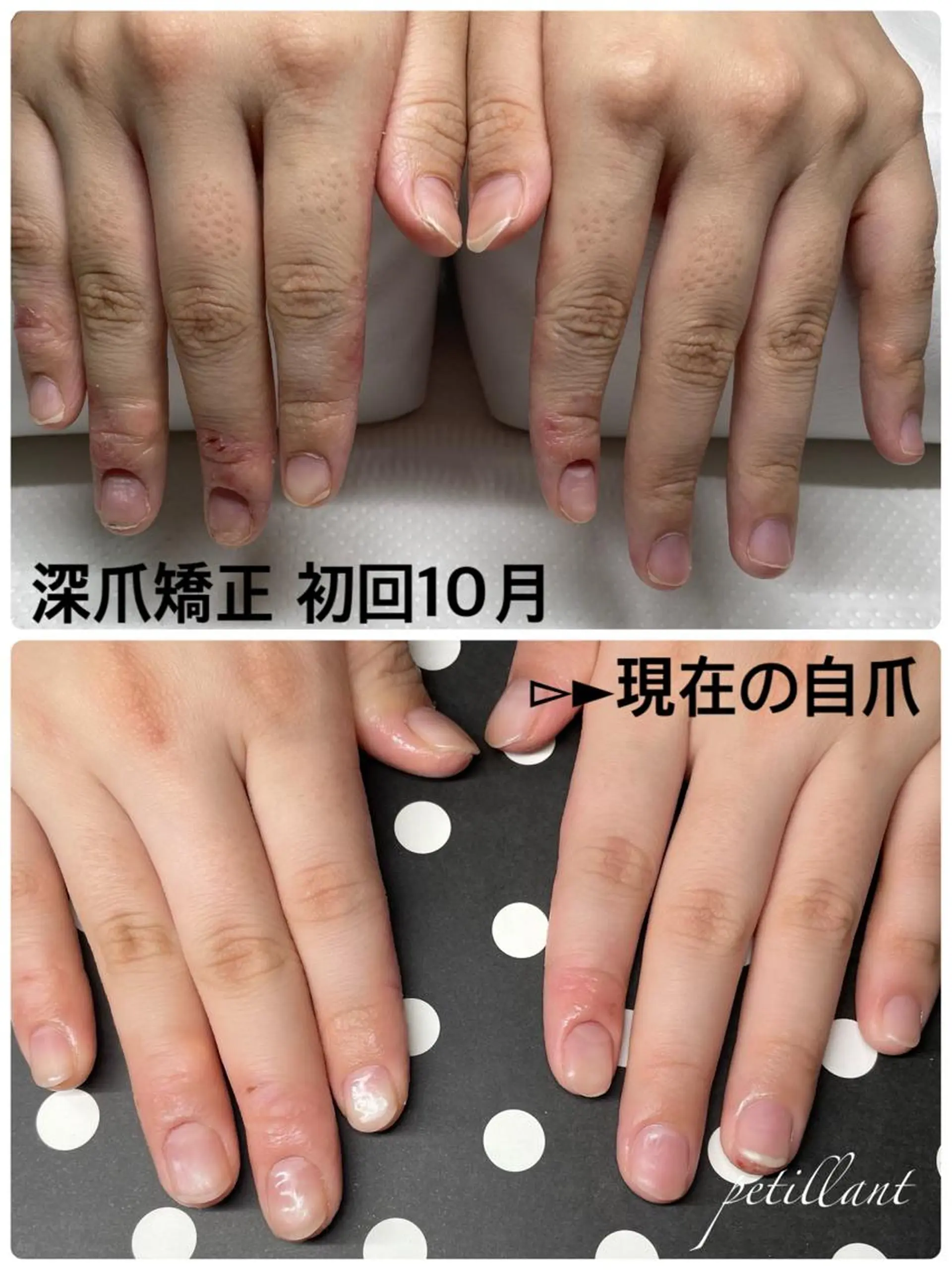ネイル 長さ出し ジェルネイル ハンドネイル ハンドケア petillant所属・nail salon petillantのネイルデザイン