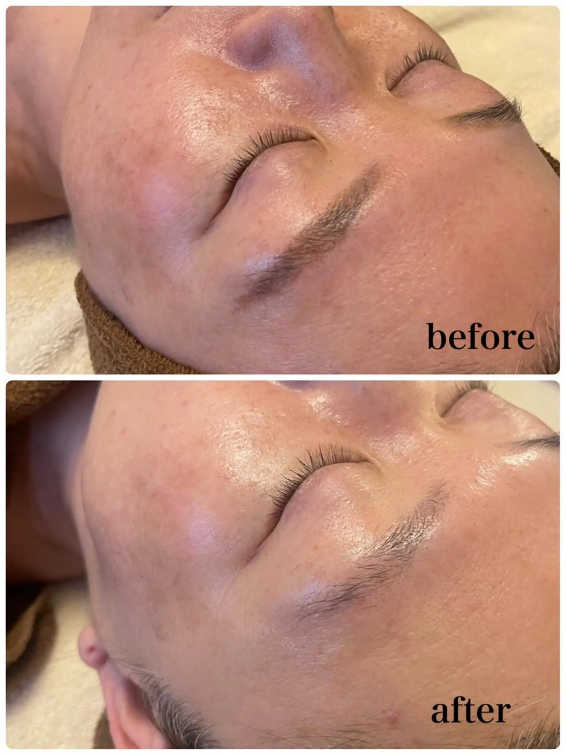 調律エステ /美KISSのその他イメージ