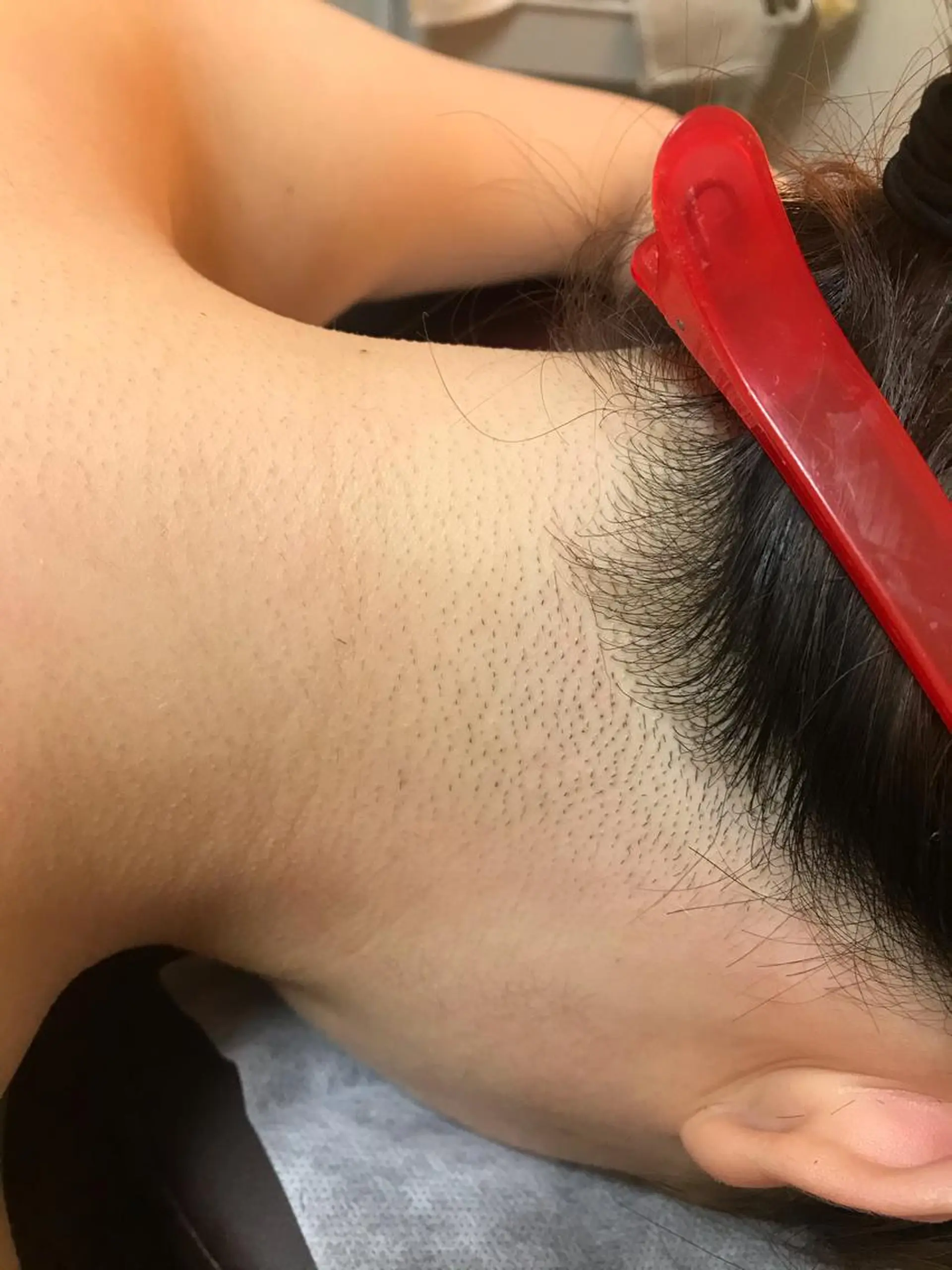 脱毛 サロンドプララン所属・サロンド プラランのエステ・リラクイメージ