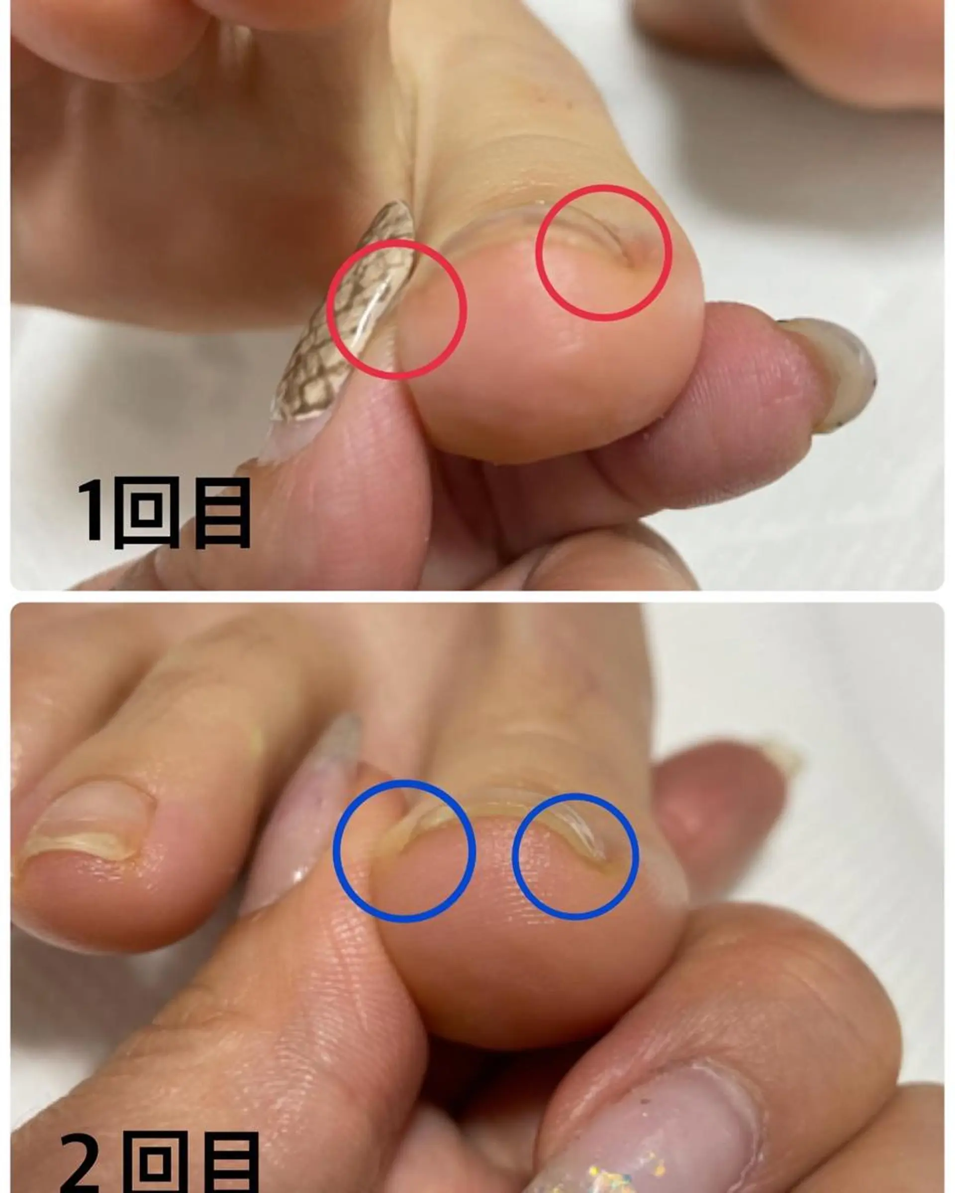 ネイル アートネイル フレンチネイル ジェルネイル グラデーション マグネットネイル フットネイル NAIL.331所属・Nail 331のネイルデザイン