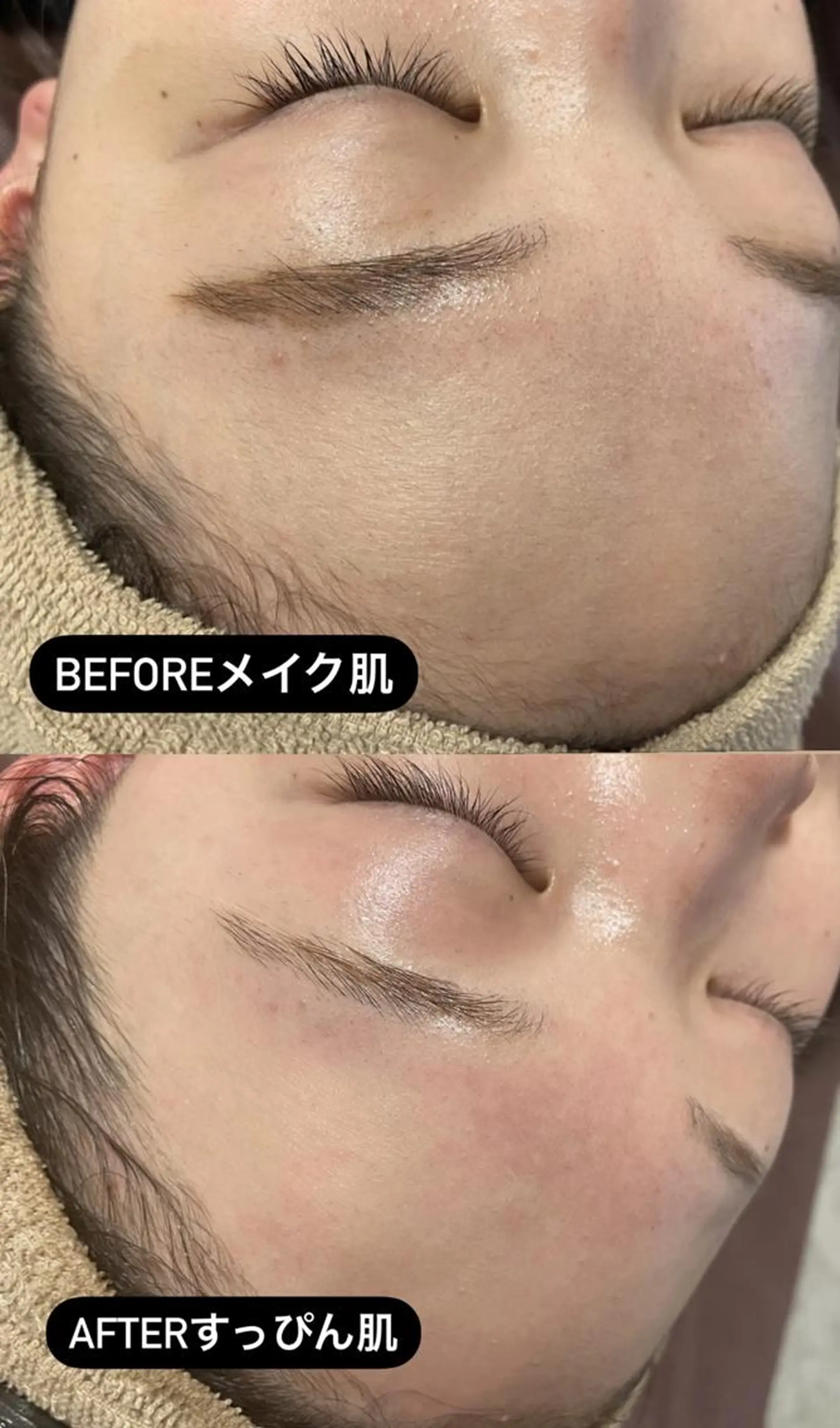 マツエク・マツパ キッズ メンズ アイブロウ 脱毛 Epina 千葉店 【エピナ】のエステ・リラクイメージ