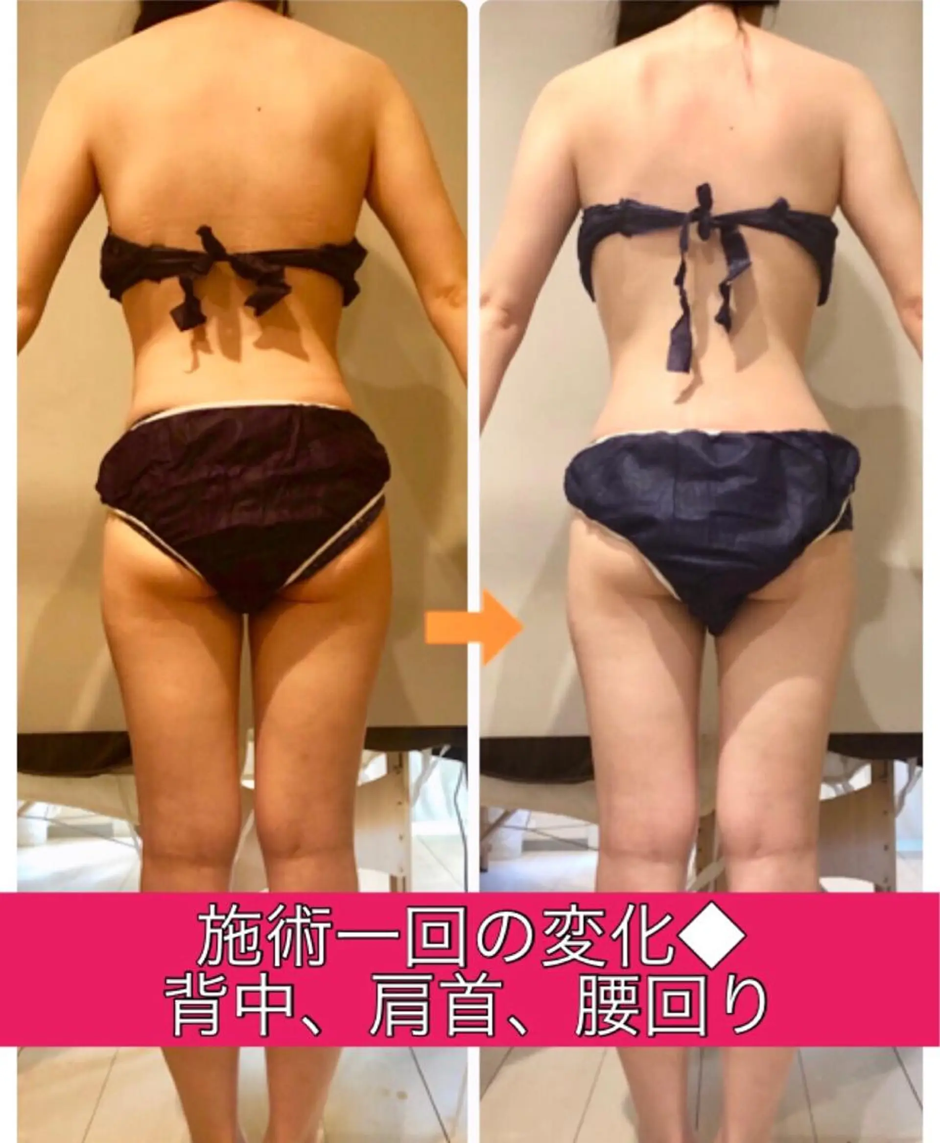 ロング カラー パーマ ヘアアレンジ メンズ キッズ ネイル マツエク・マツパ ‍痩身＆ボディ 結果出し🌟丹野のエステ・リラクイメージ